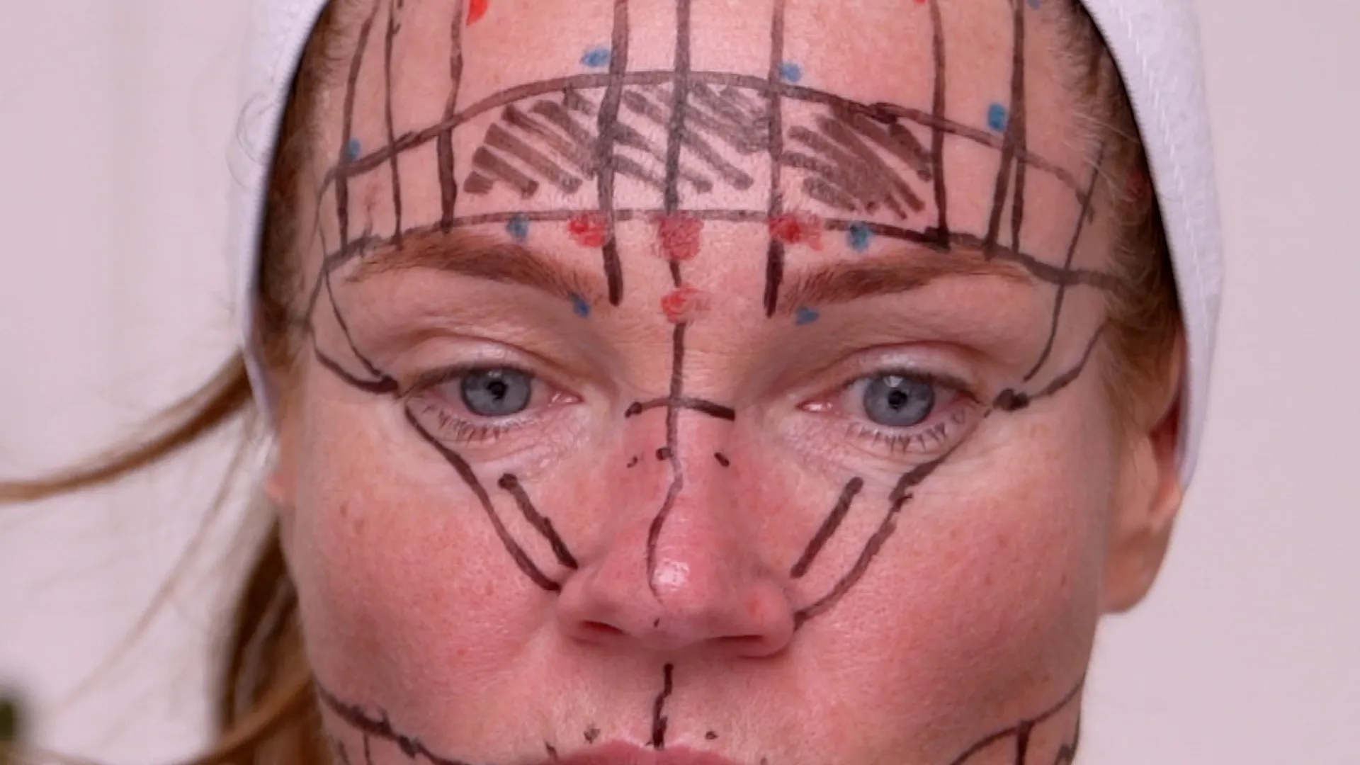 Face & Neck Map 200-UnitS Of Korean Toxin Dehantox - treatment image