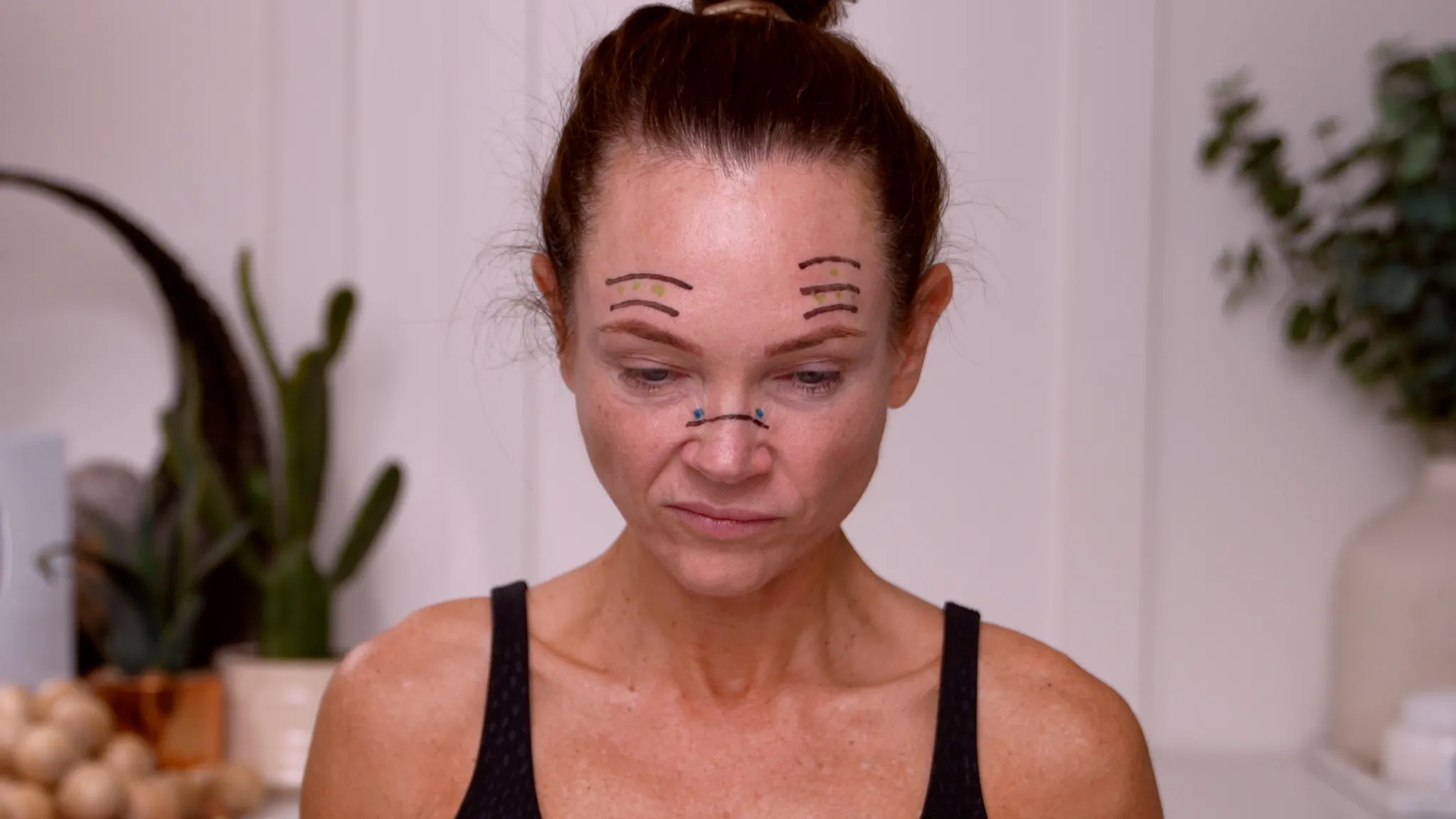 Dehantox 100U Mapping Update: Best Practices for Touch-Up Treatments - treatment image