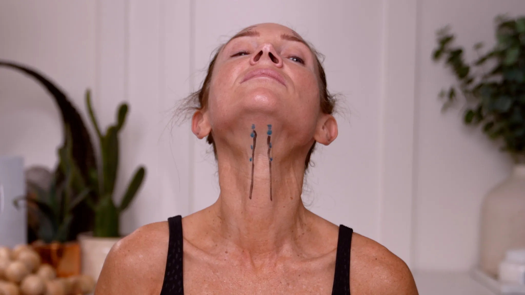 Dehantox 100U Mapping Update: Best Practices for Touch-Up Treatments - treatment image