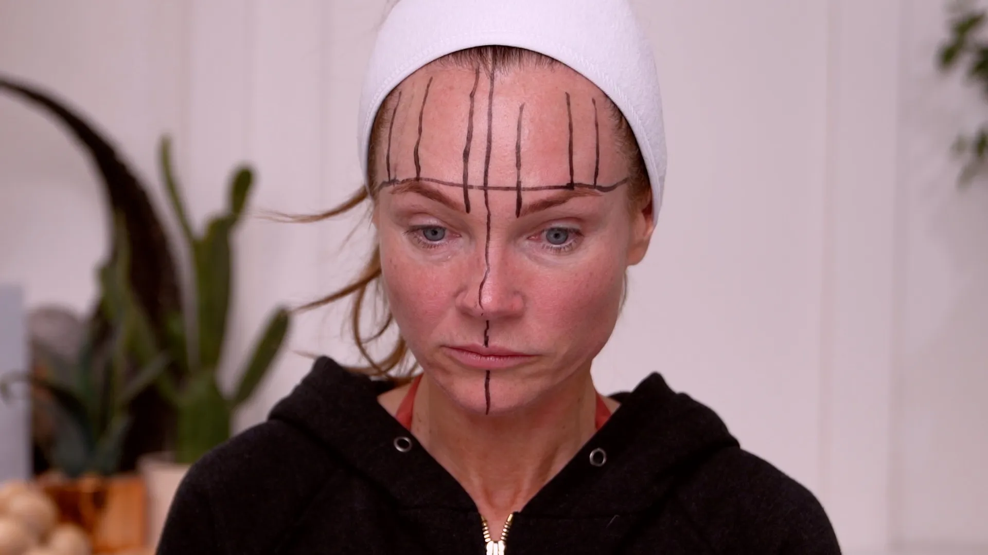 Face & Neck Map 200-UnitS Of Korean Toxin Dehantox - treatment image