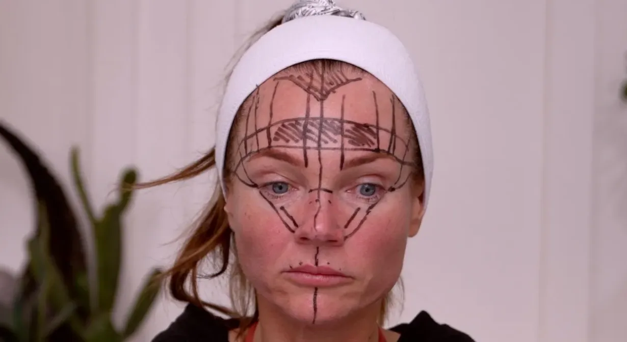 Face & Neck Map 200-UnitS Of Korean Toxin Dehantox - treatment image