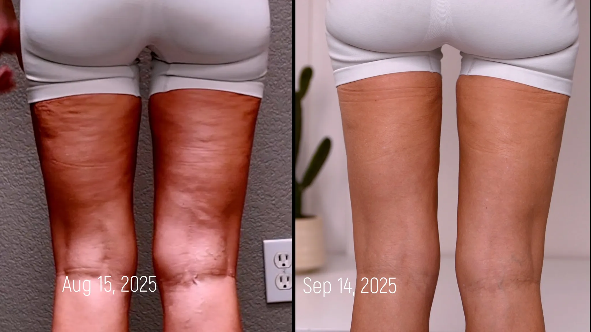 The Glow Stack PeptideS for Skin, Recovery, and Performance - treatment image