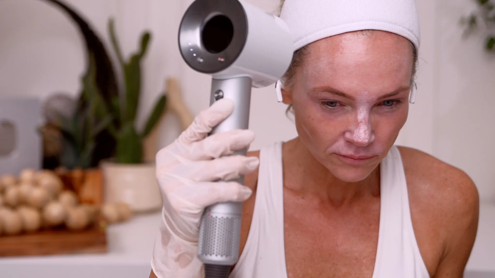 30% TCA Chemical Peel — What No One Shows - treatment image