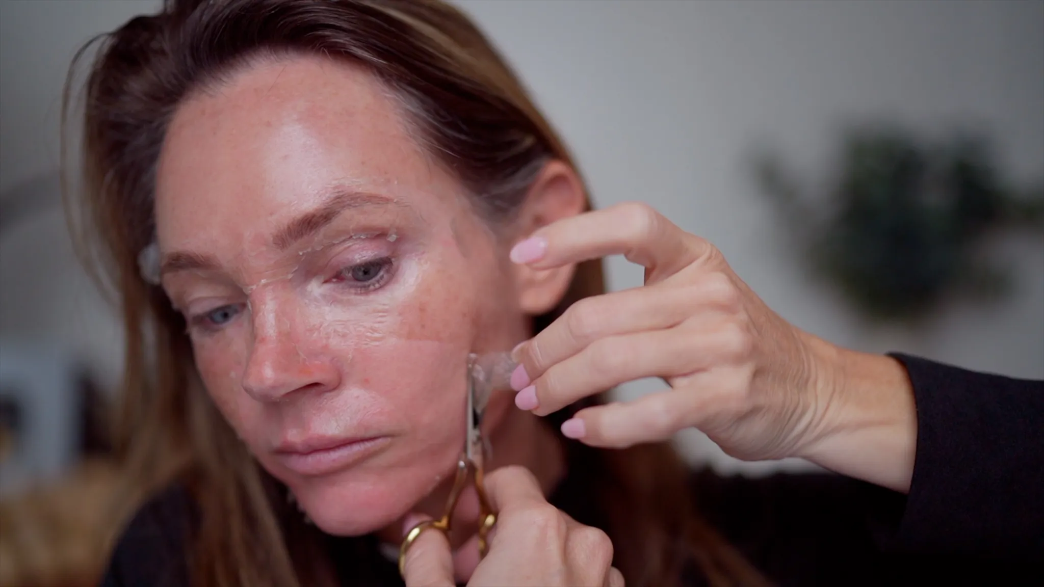 DIY 30% TCA Peel at Home (Full Demo + Recovery) - treatment image