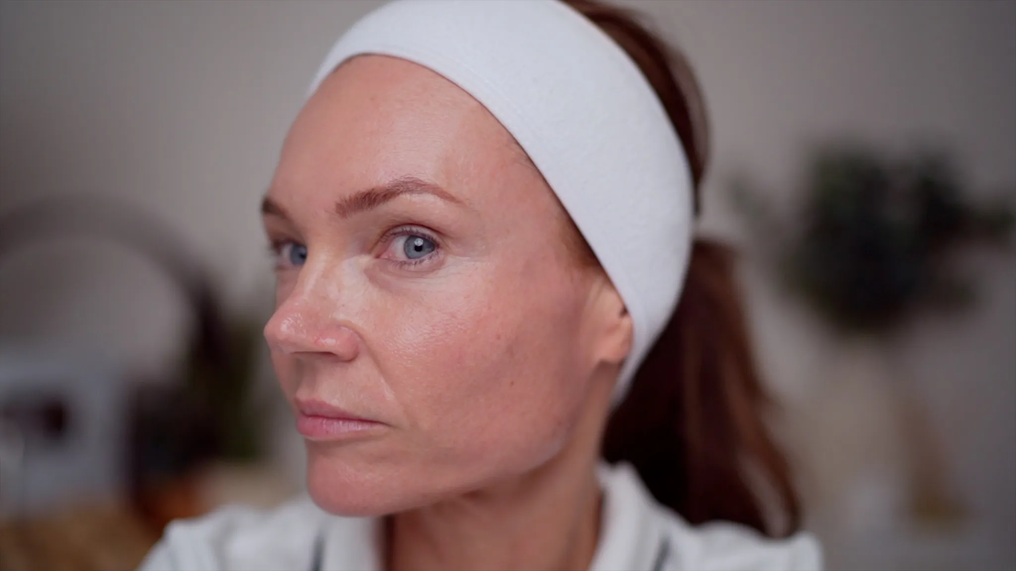 DIY 30% TCA Peel at Home (Full Demo + Recovery) - treatment image