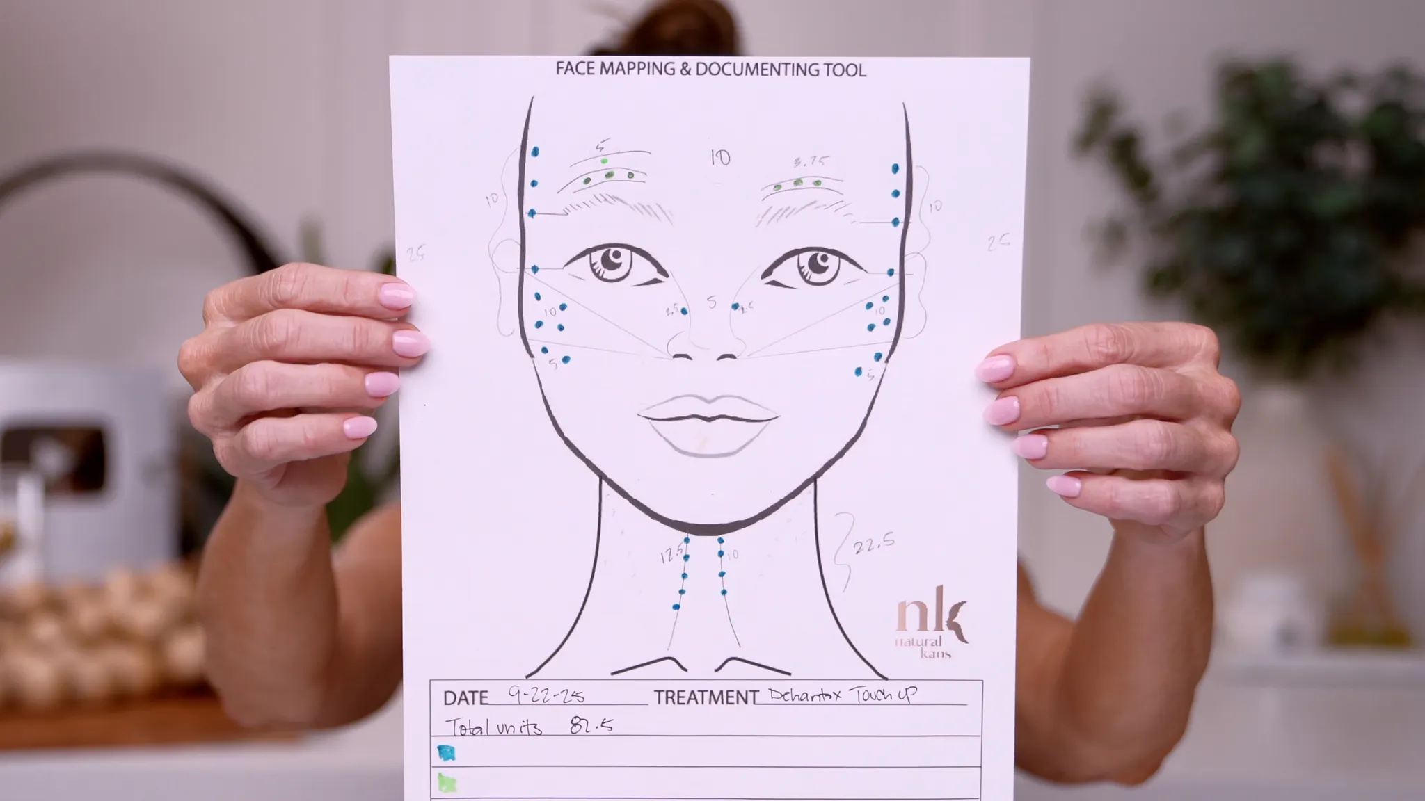 Dehantox 100U Mapping Update: Best Practices for Touch-Up Treatments - treatment image