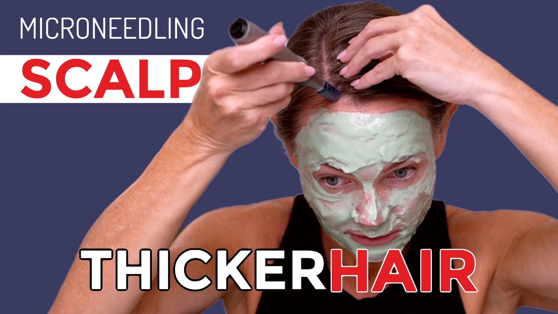 Hair Growth Support? Scalp Microneedling with Dr. Pen M8S + Elaxen PDRN