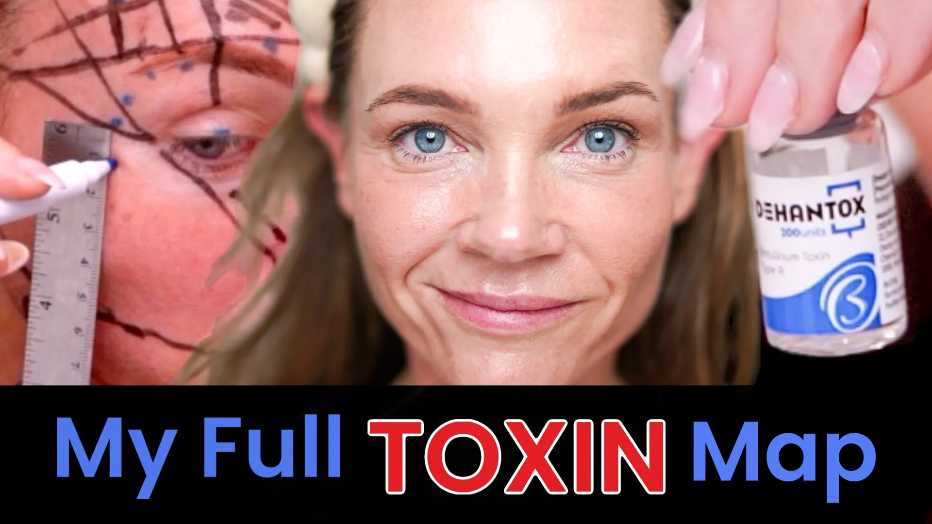 Face & Neck Map 200-UnitS KOREAN Toxin Dehantox