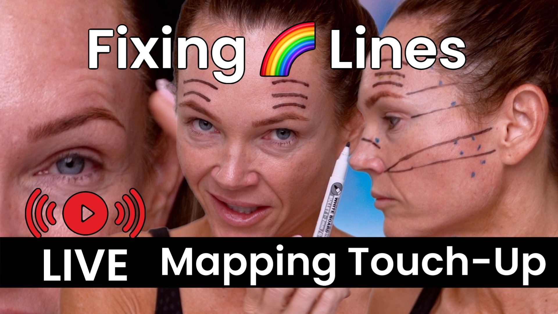 How to Fix Brow “Rainbow” Lines with Dehantox 100U Mapping