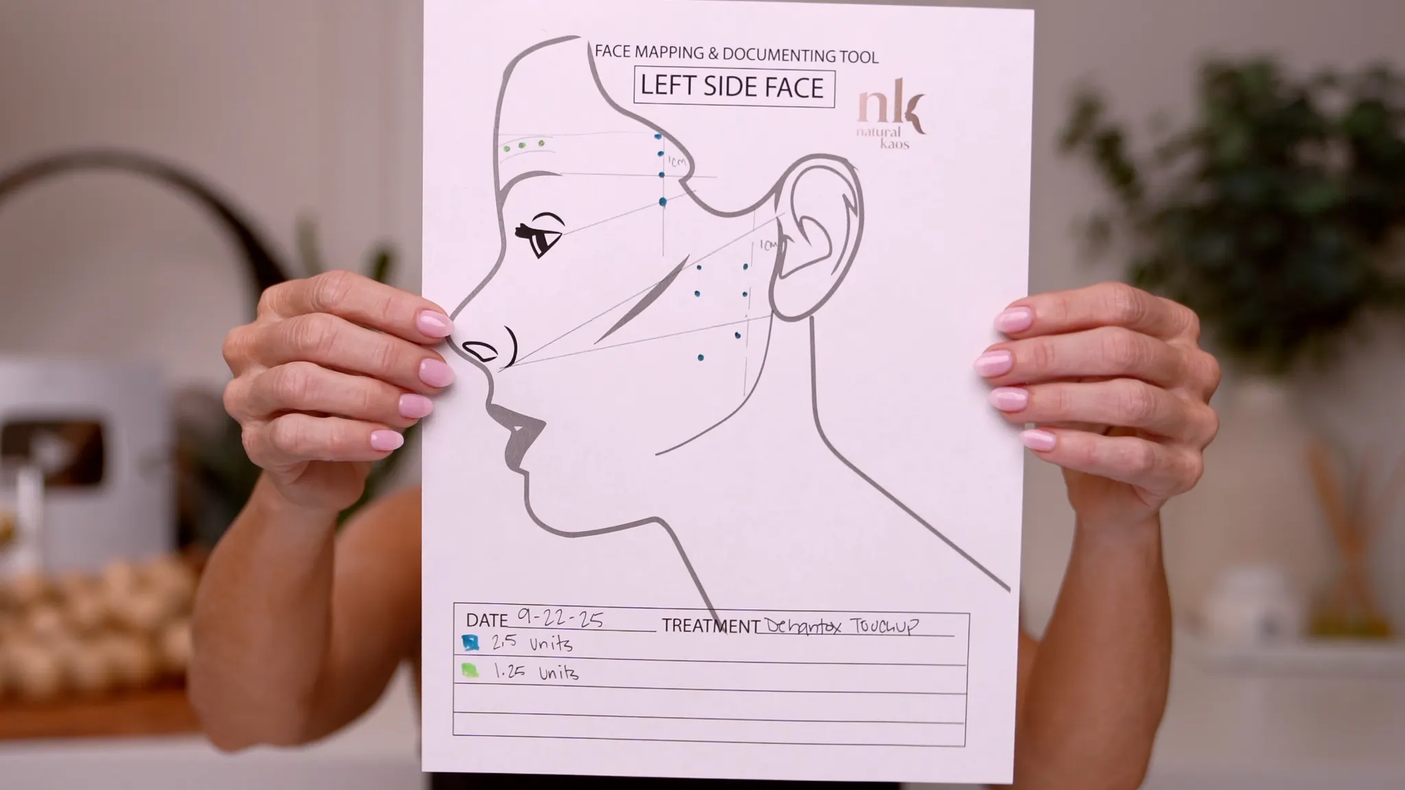 Dehantox 100U Mapping Update: Best Practices for Touch-Up Treatments - treatment image