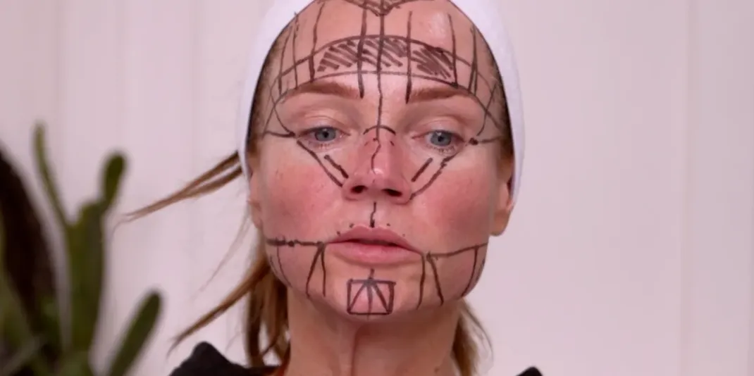 Face & Neck Map 200-UnitS Of Korean Toxin Dehantox - treatment image