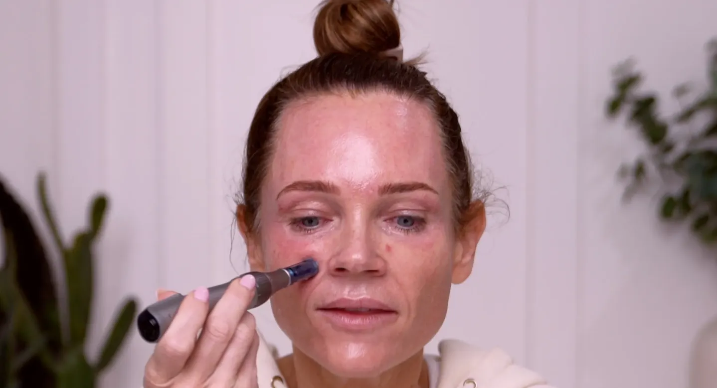 Best Skincare Devices You Need | LED, Microcurrent & Microneedling Picks - treatment image