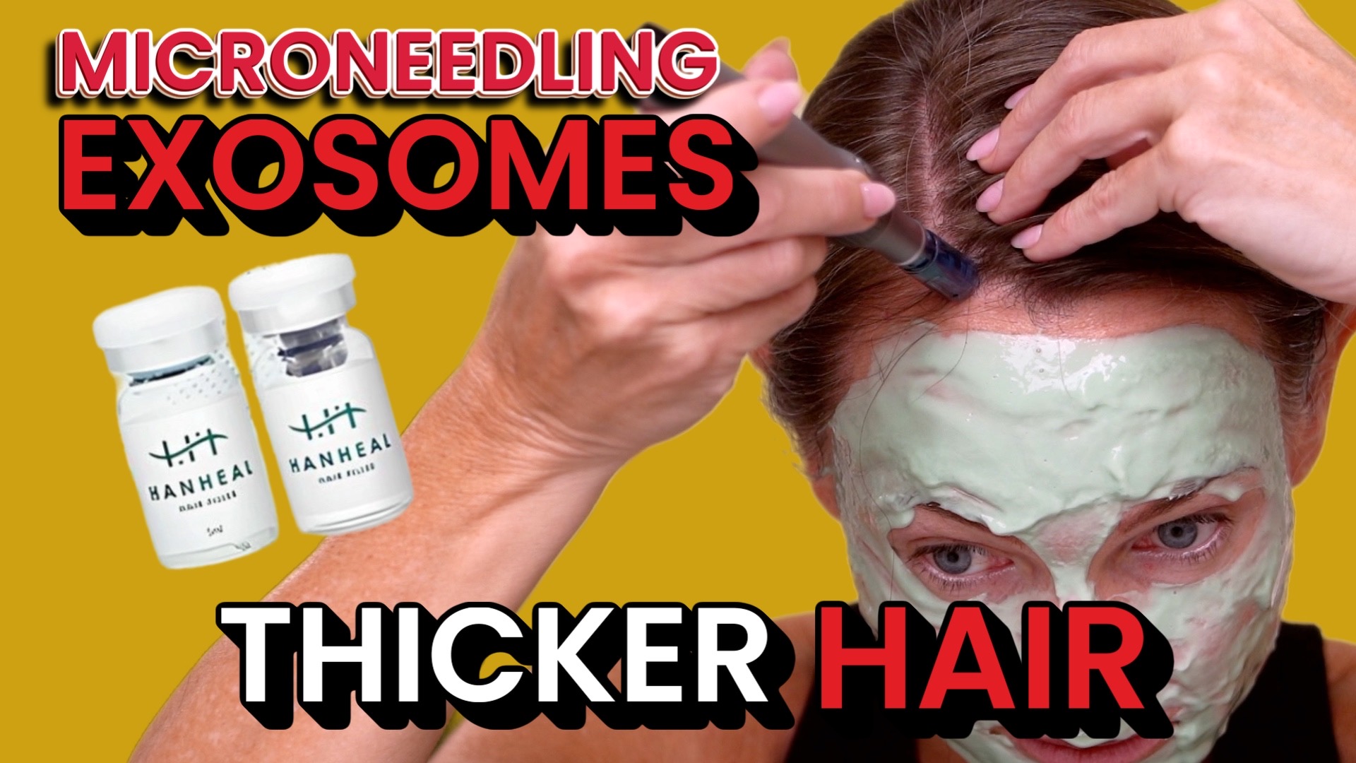 Scalp Microneedling & Hanheal Hair Filler: Boosting Growth and Scalp Health
