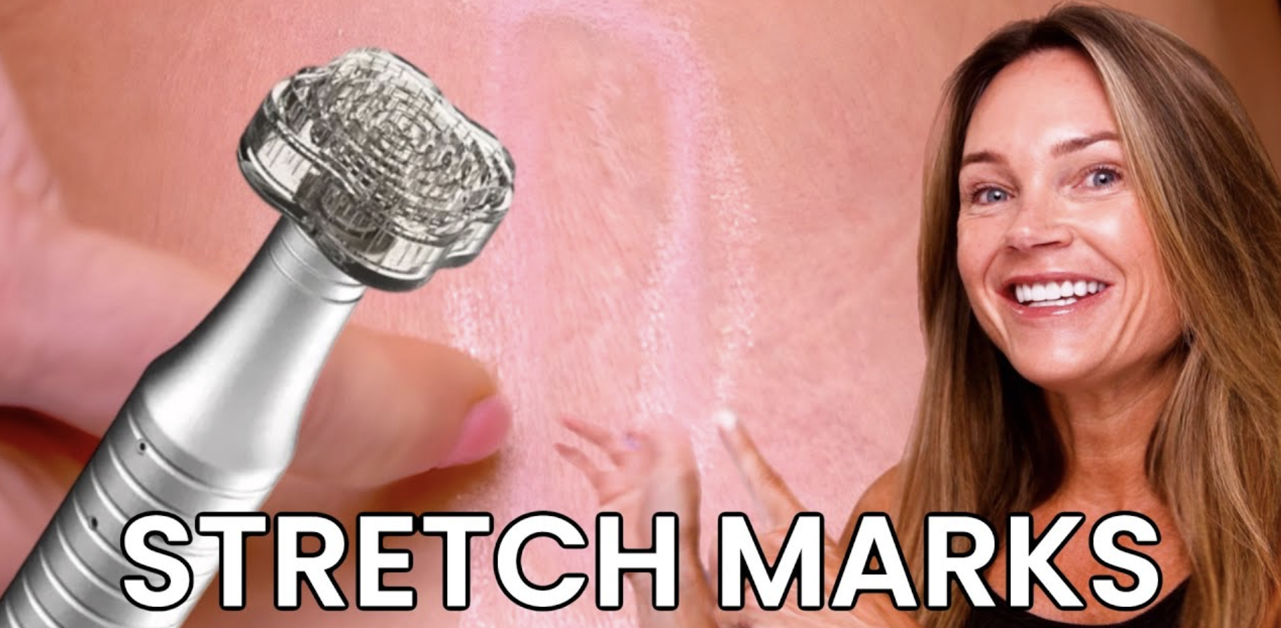 Erase Stretch Marks With Me Too Healer PDRN