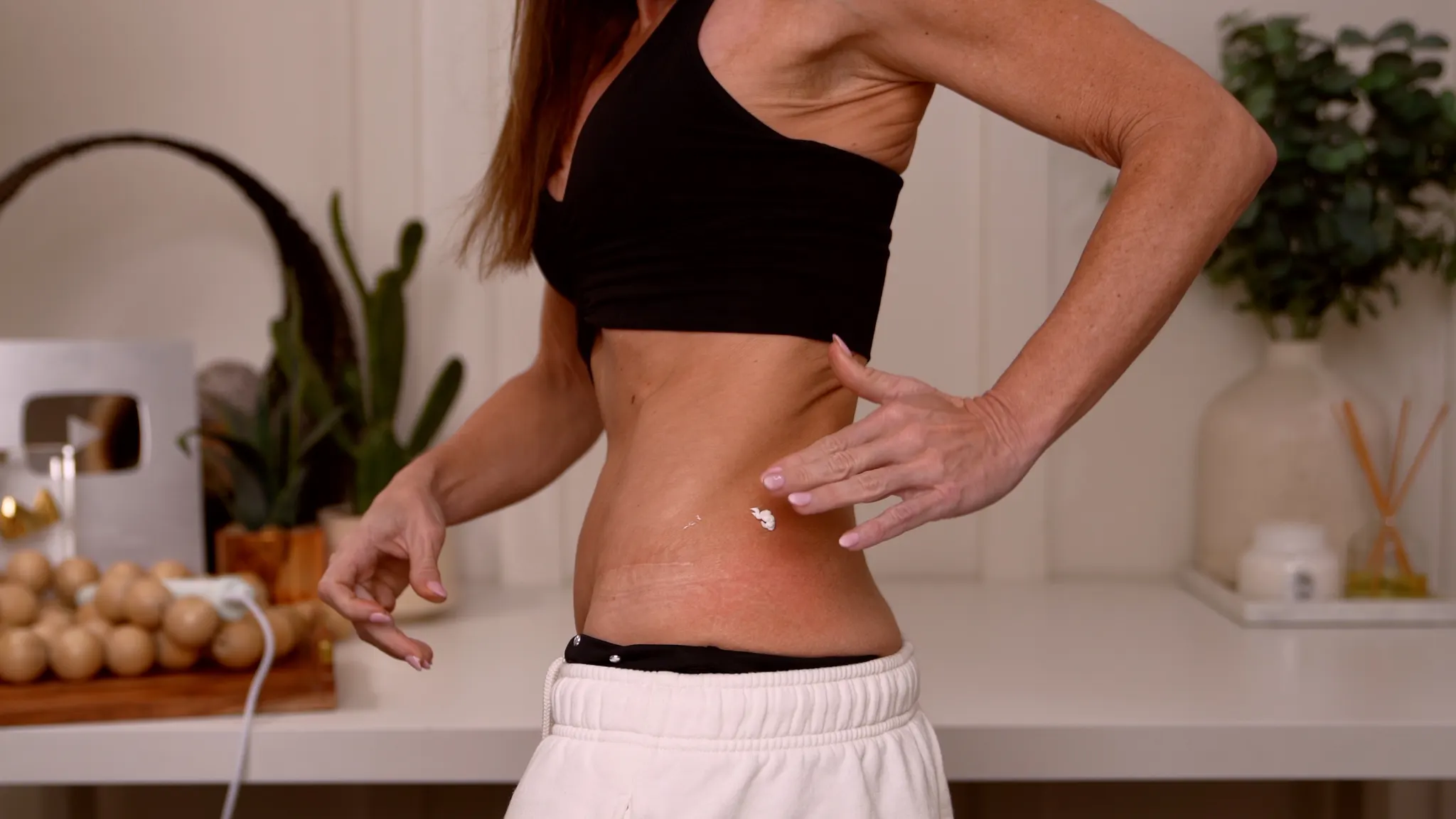 Microneedling Stretch Marks with Results - treatment image