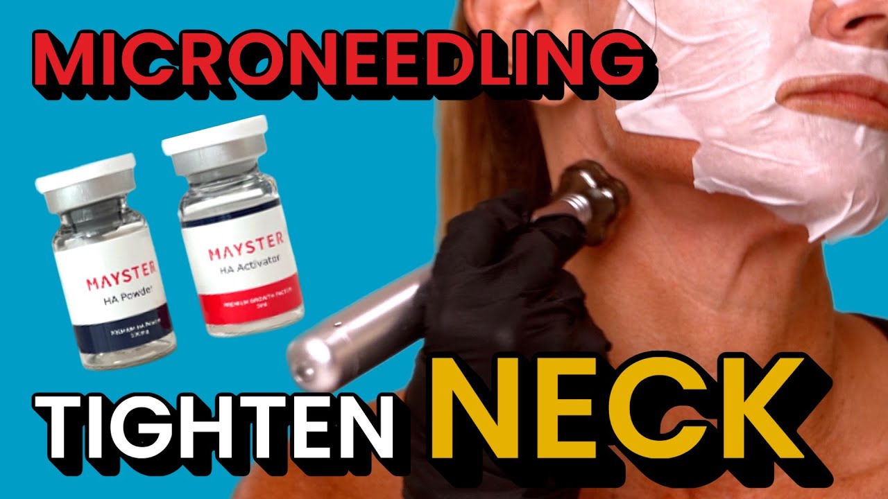 How to Firm Your Neck and Chest: Microneedling with Channel Pro Pen and Mayster HA Booster
