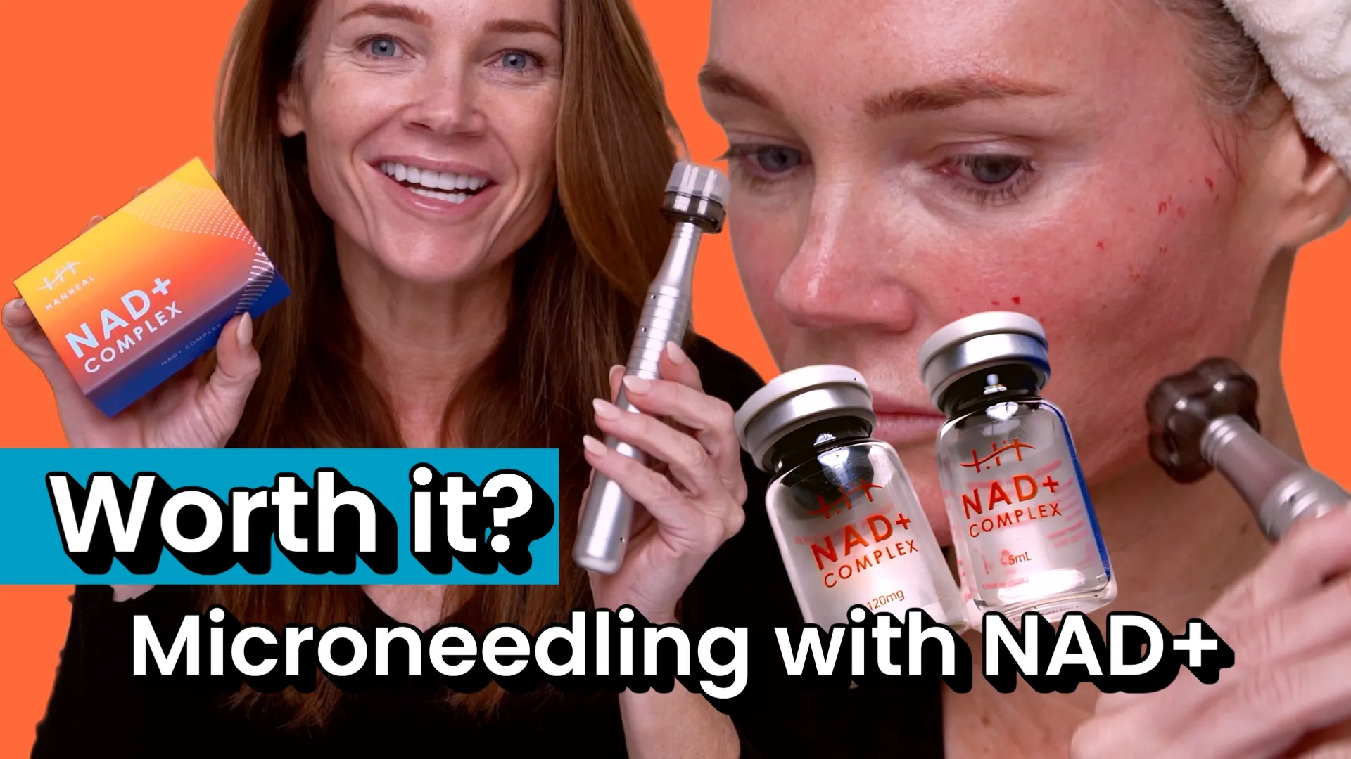 Microneedling With NAD+: What Happened When I Tested an NAD+ Complex on My Face