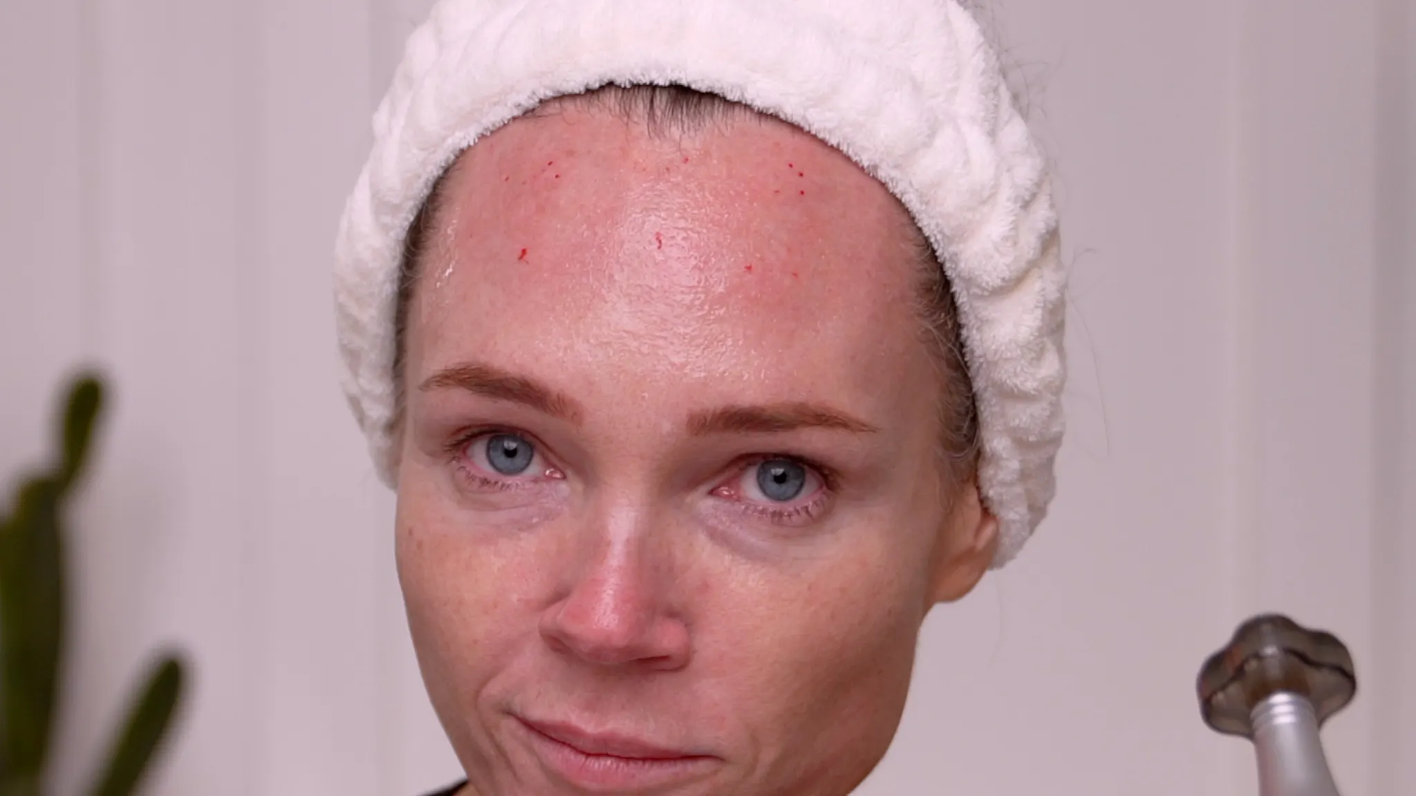 Microneedling With NAD+: What Happened When I Tested an NAD+ Complex on My Face - treatment image