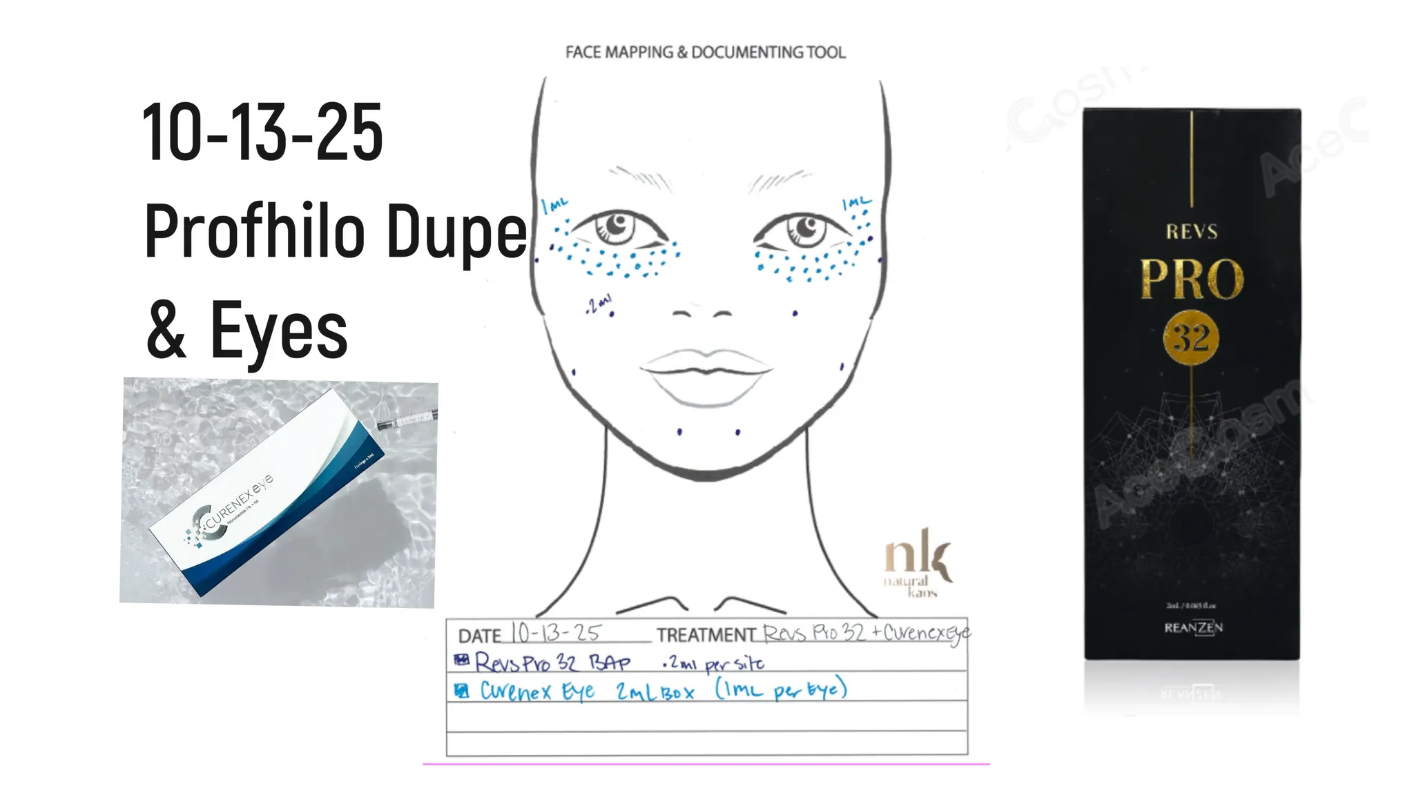 Every Injectable I Did in 2025: Full Timeline, Products Used & Why I Chose Them - treatment image