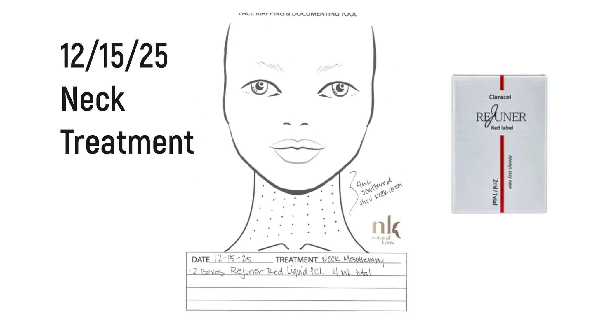 Every Injectable I Did in 2025: Full Timeline, Products Used & Why I Chose Them - treatment image