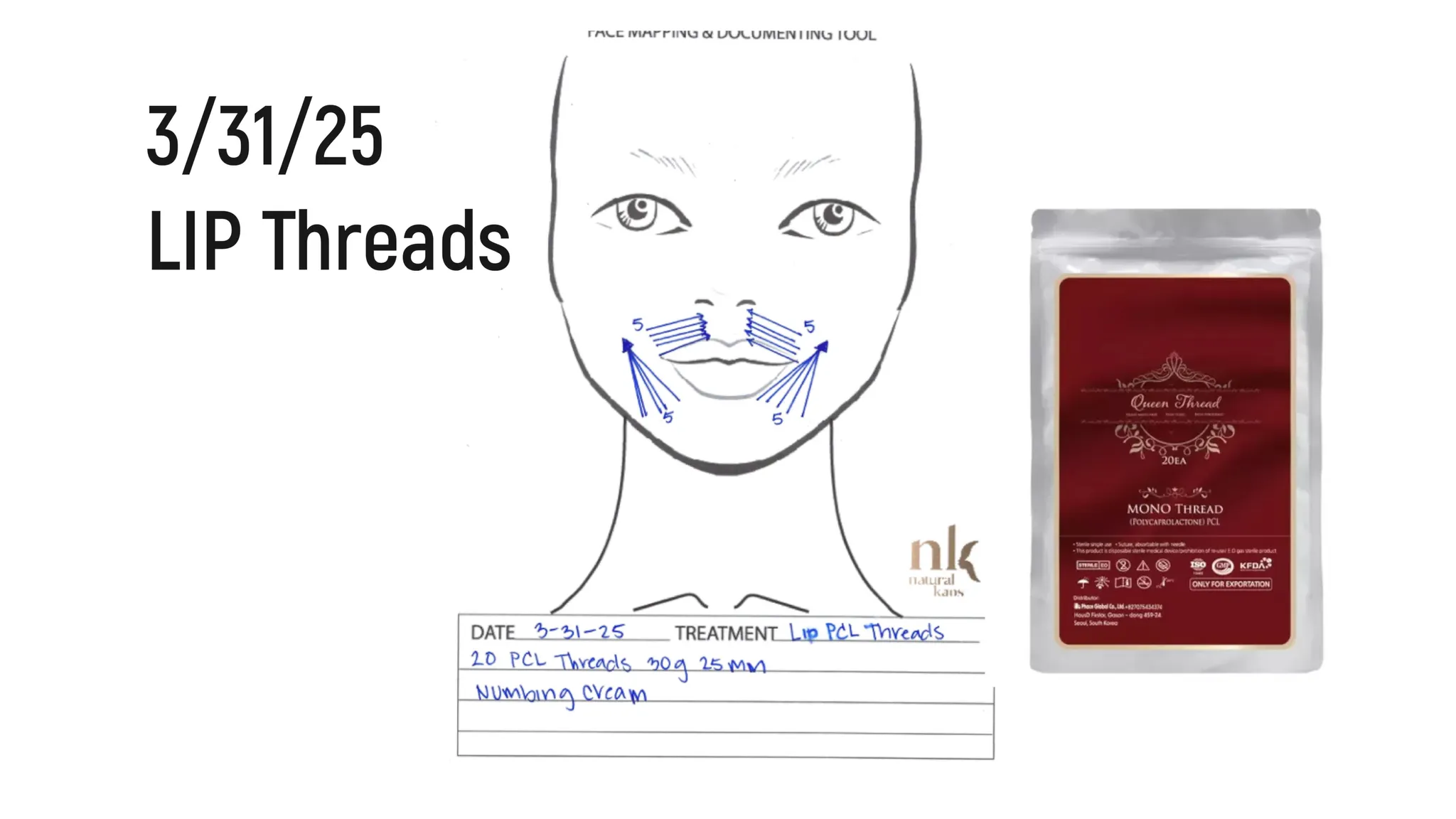 Every Injectable I Did in 2025: Full Timeline, Products Used & Why I Chose Them - treatment image