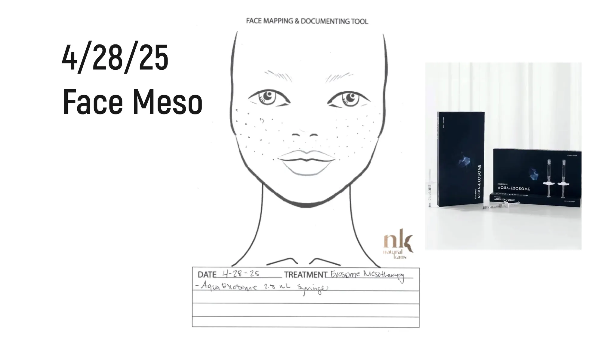 Every Injectable I Did in 2025: Full Timeline, Products Used & Why I Chose Them - treatment image