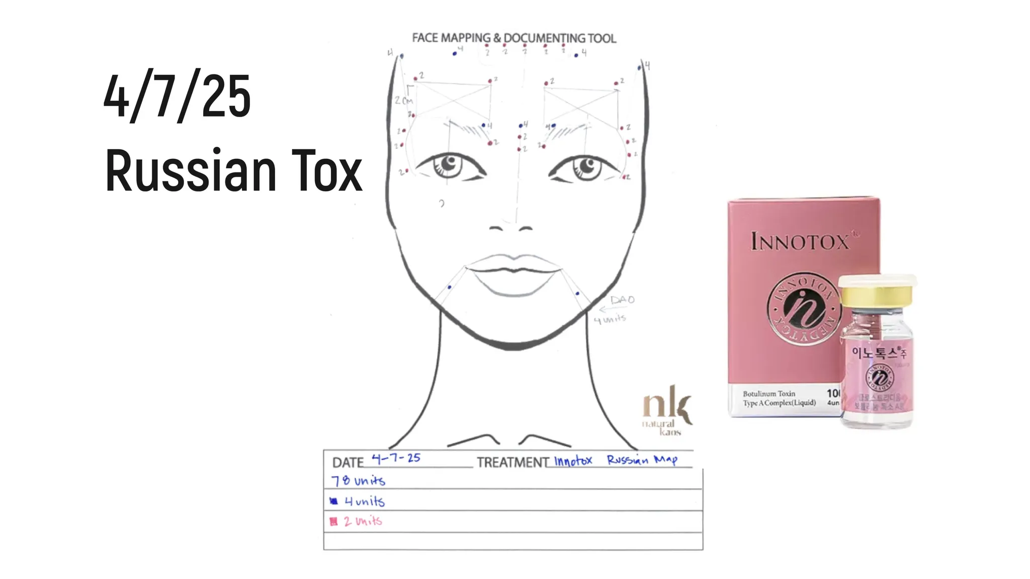 Every Injectable I Did in 2025: Full Timeline, Products Used & Why I Chose Them - treatment image