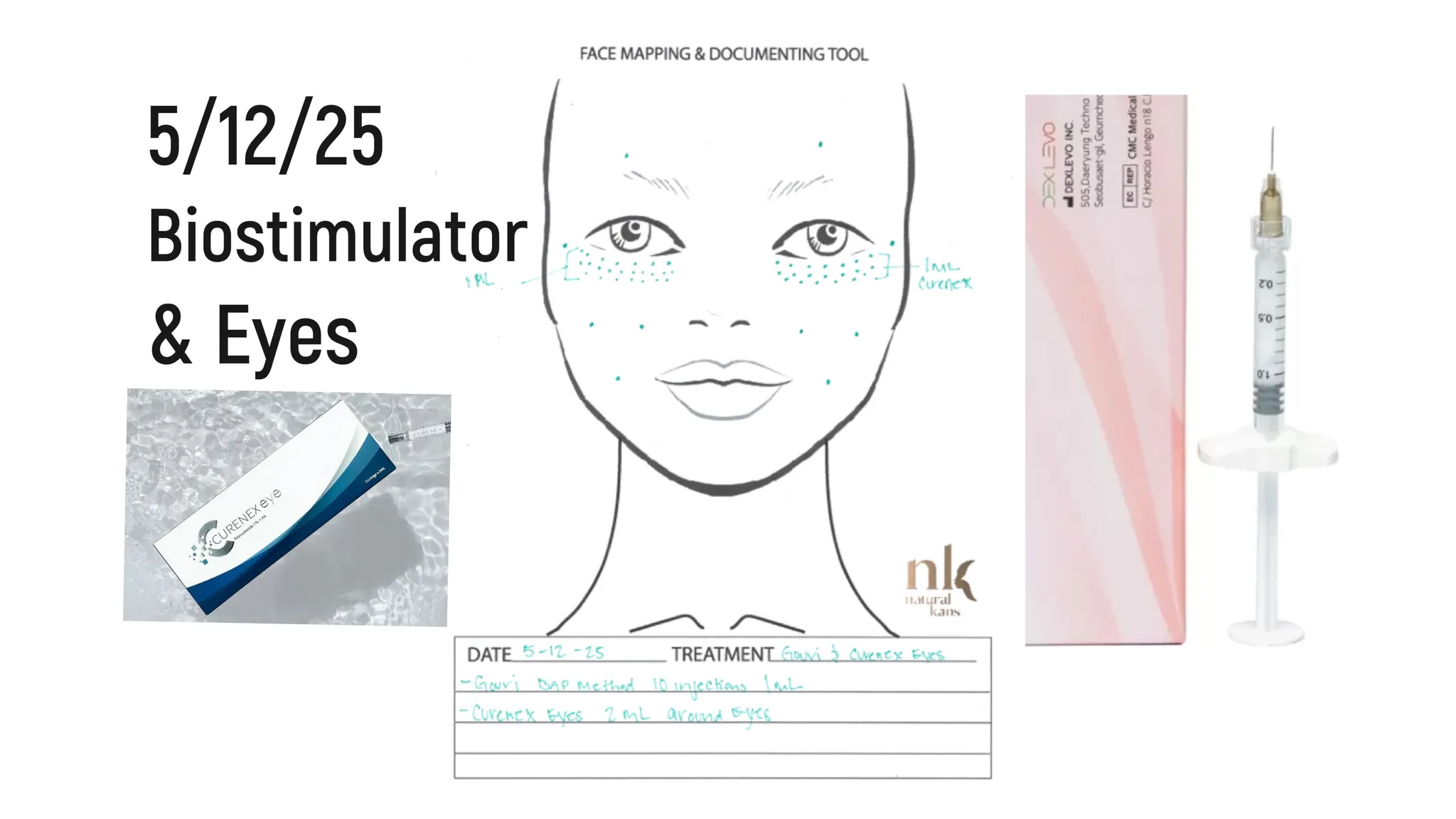 Every Injectable I Did in 2025: Full Timeline, Products Used & Why I Chose Them - treatment image