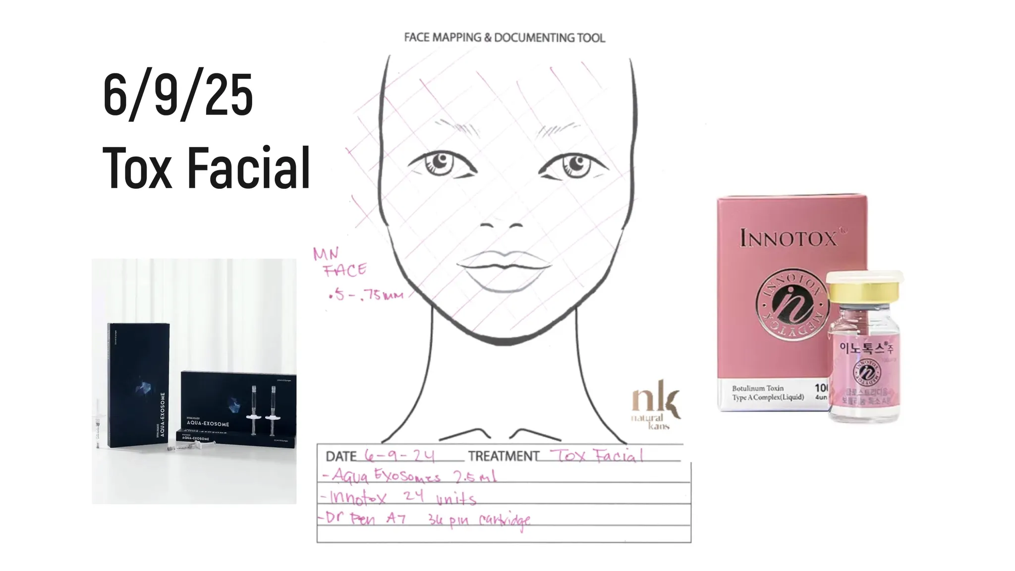 Every Injectable I Did in 2025: Full Timeline, Products Used & Why I Chose Them - treatment image