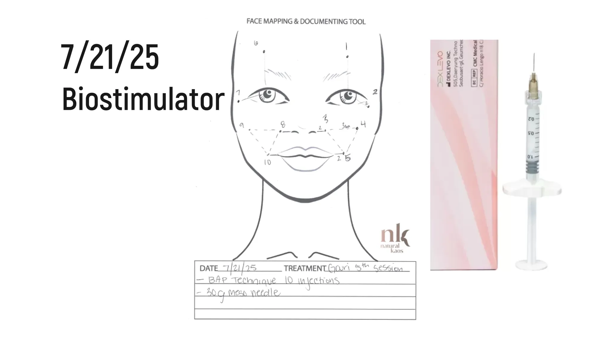 Every Injectable I Did in 2025: Full Timeline, Products Used & Why I Chose Them - treatment image