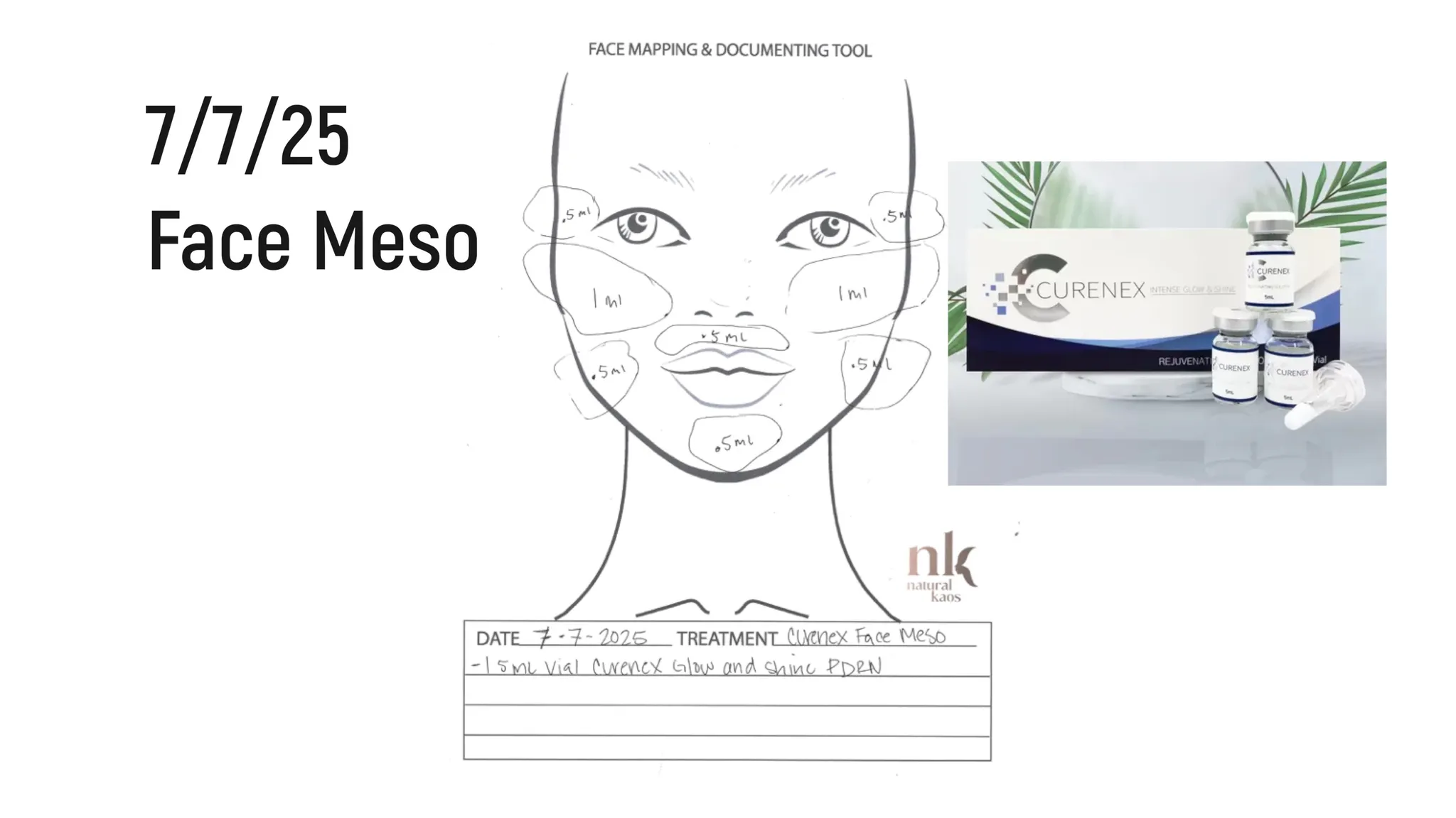 Every Injectable I Did in 2025: Full Timeline, Products Used & Why I Chose Them - treatment image