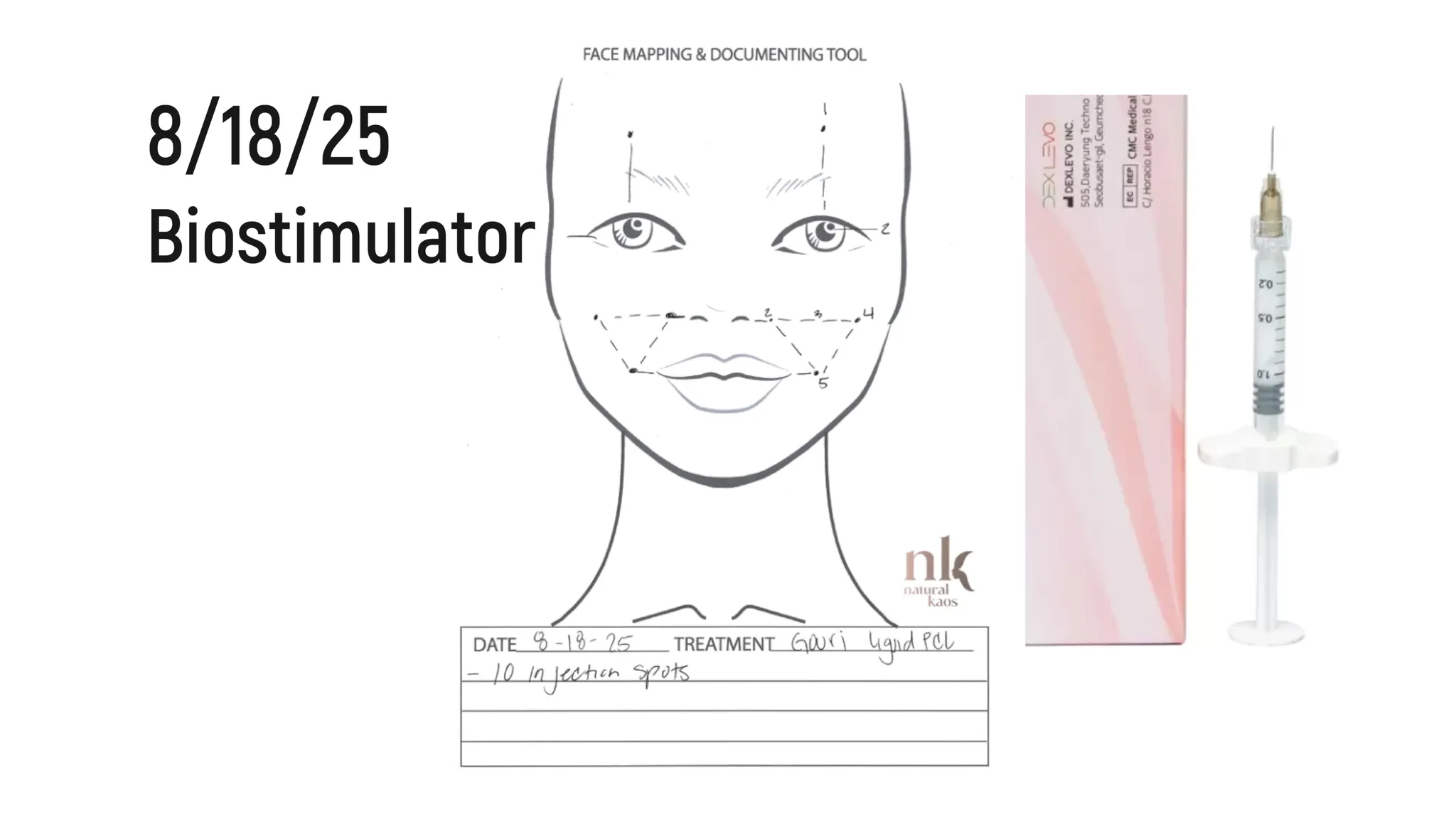 Every Injectable I Did in 2025: Full Timeline, Products Used & Why I Chose Them - treatment image