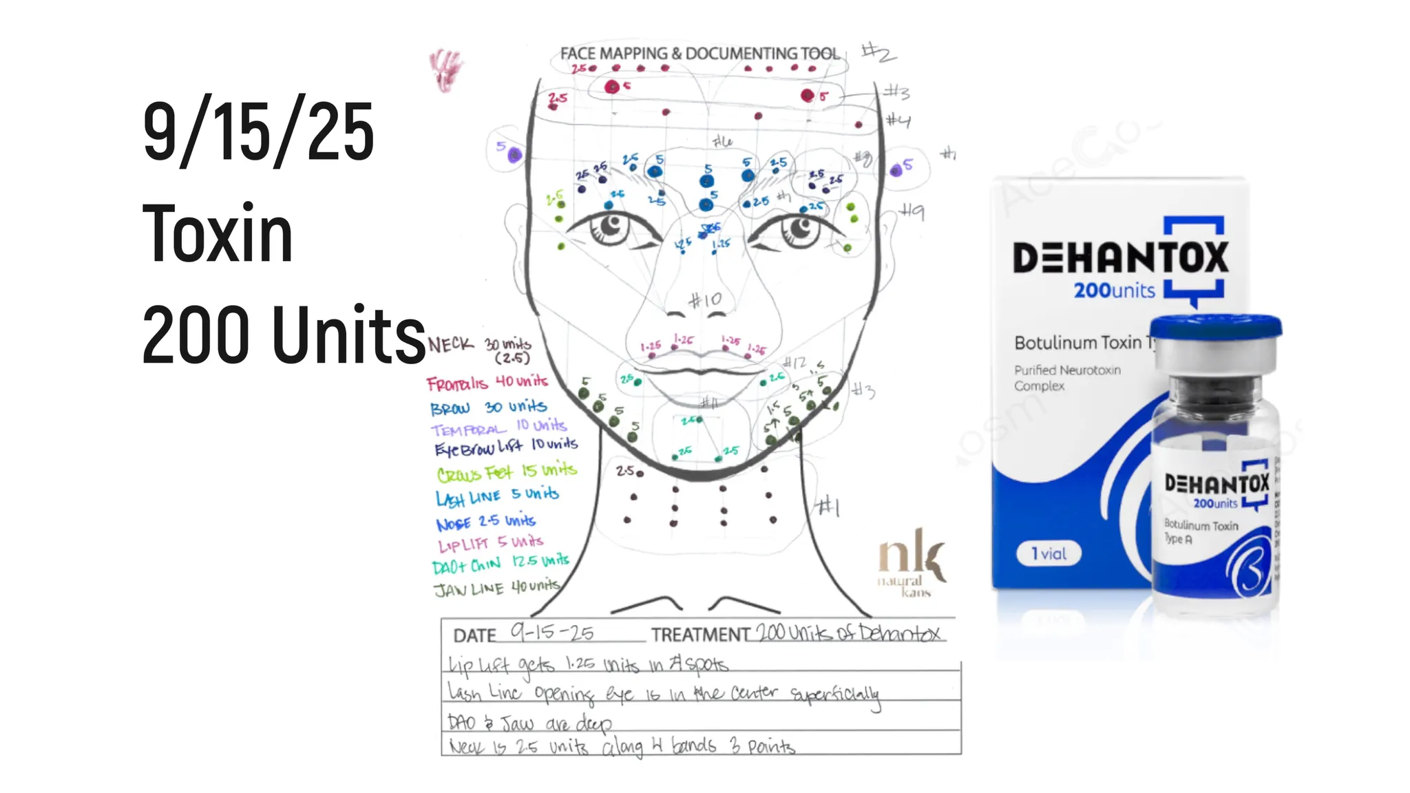 Every Injectable I Did in 2025: Full Timeline, Products Used & Why I Chose Them - treatment image