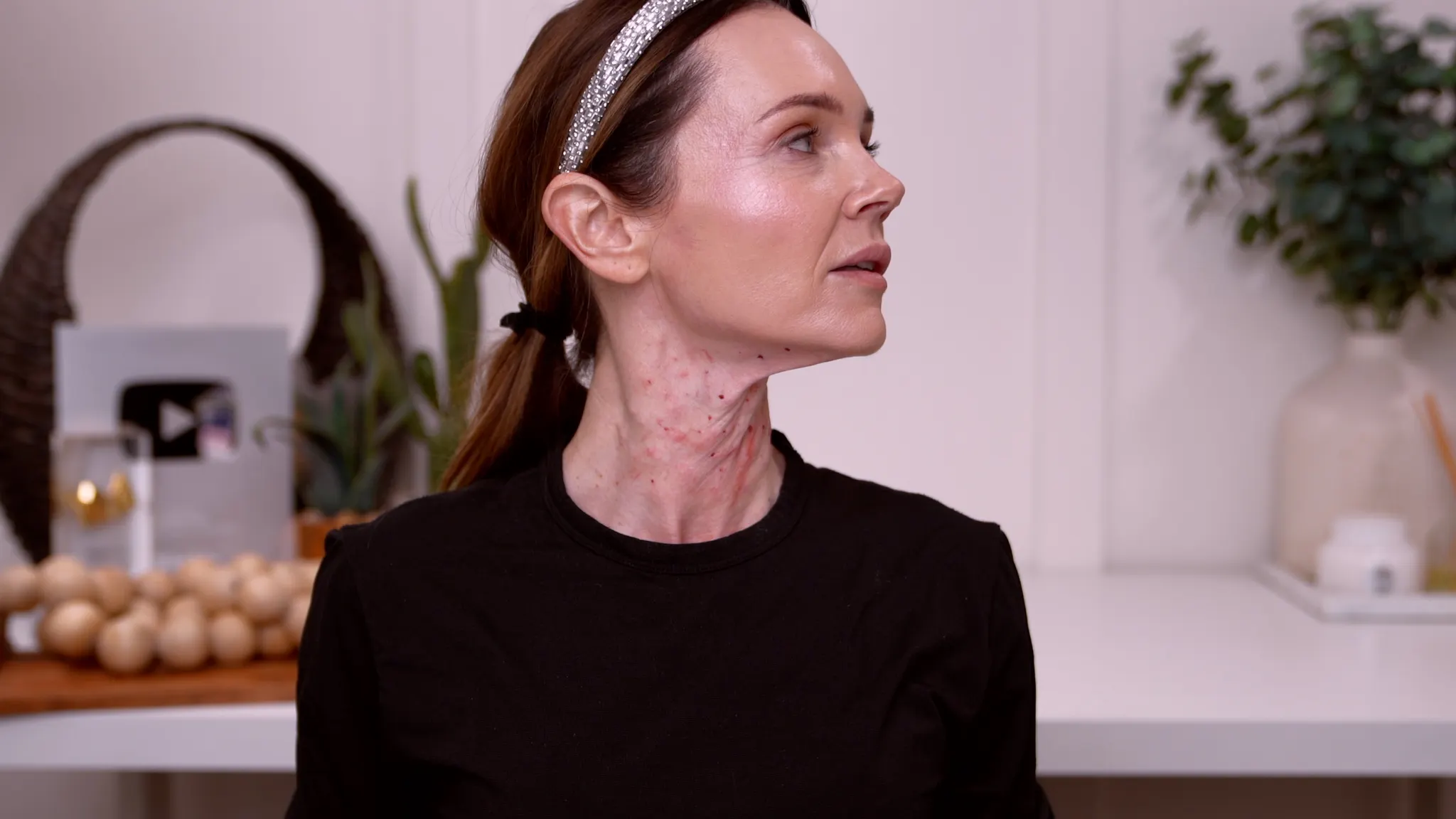 Rejuner Red Mesotherapy for Crepey Neck Skin — Complete Treatment Guide (Results + What to Expect) - treatment image