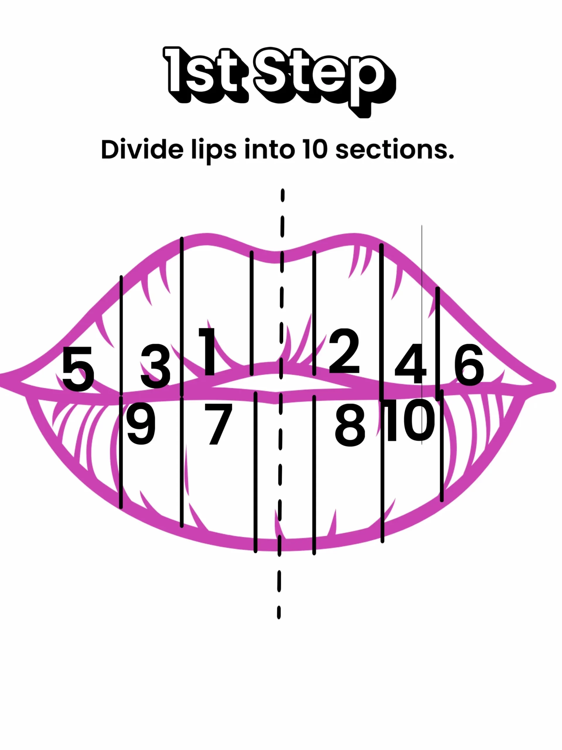 Russian Lip Filler Technique Explained: Why It Looks So Different - treatment image