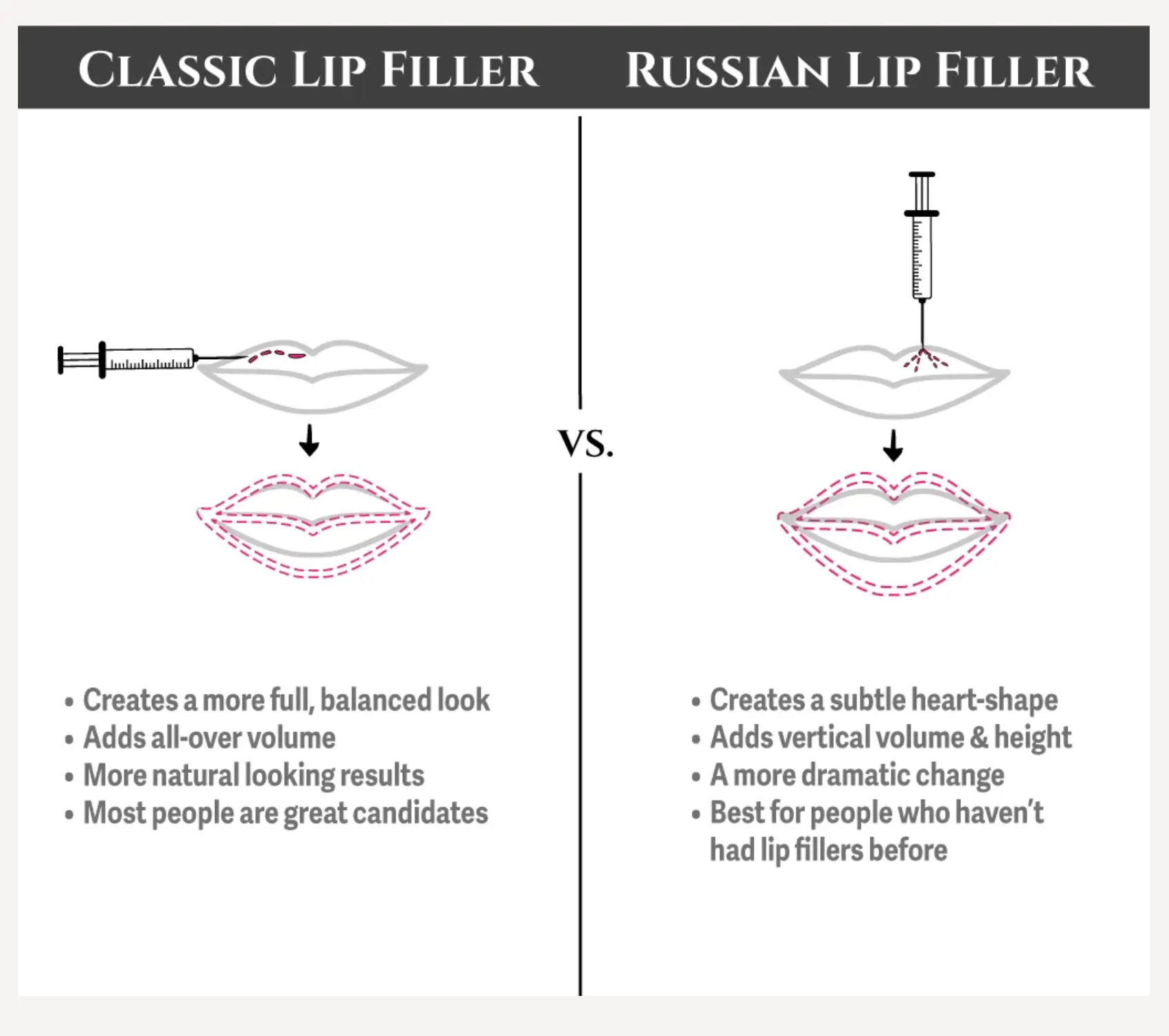 Russian Lip Filler Technique Explained: Why It Looks So Different - treatment image
