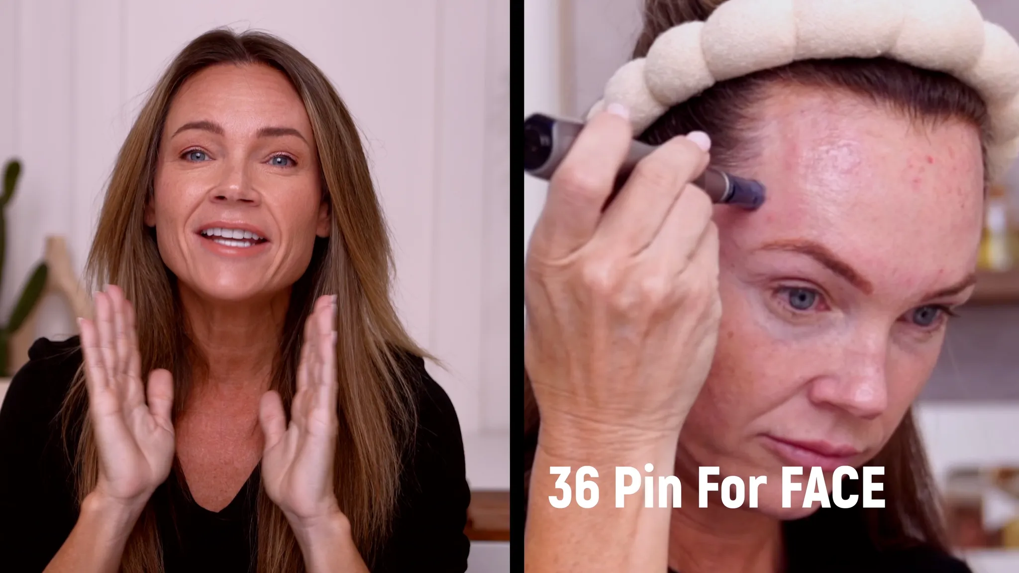 Texture Reset Routine: Peel and Microneedling for Smoother, Glowing Skin - treatment image