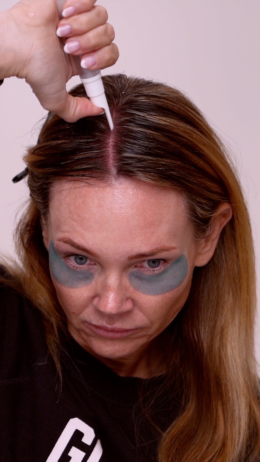 Hair Luma Microneedling for the Scalp | A Complete Regenerative Hair Routine - treatment image
