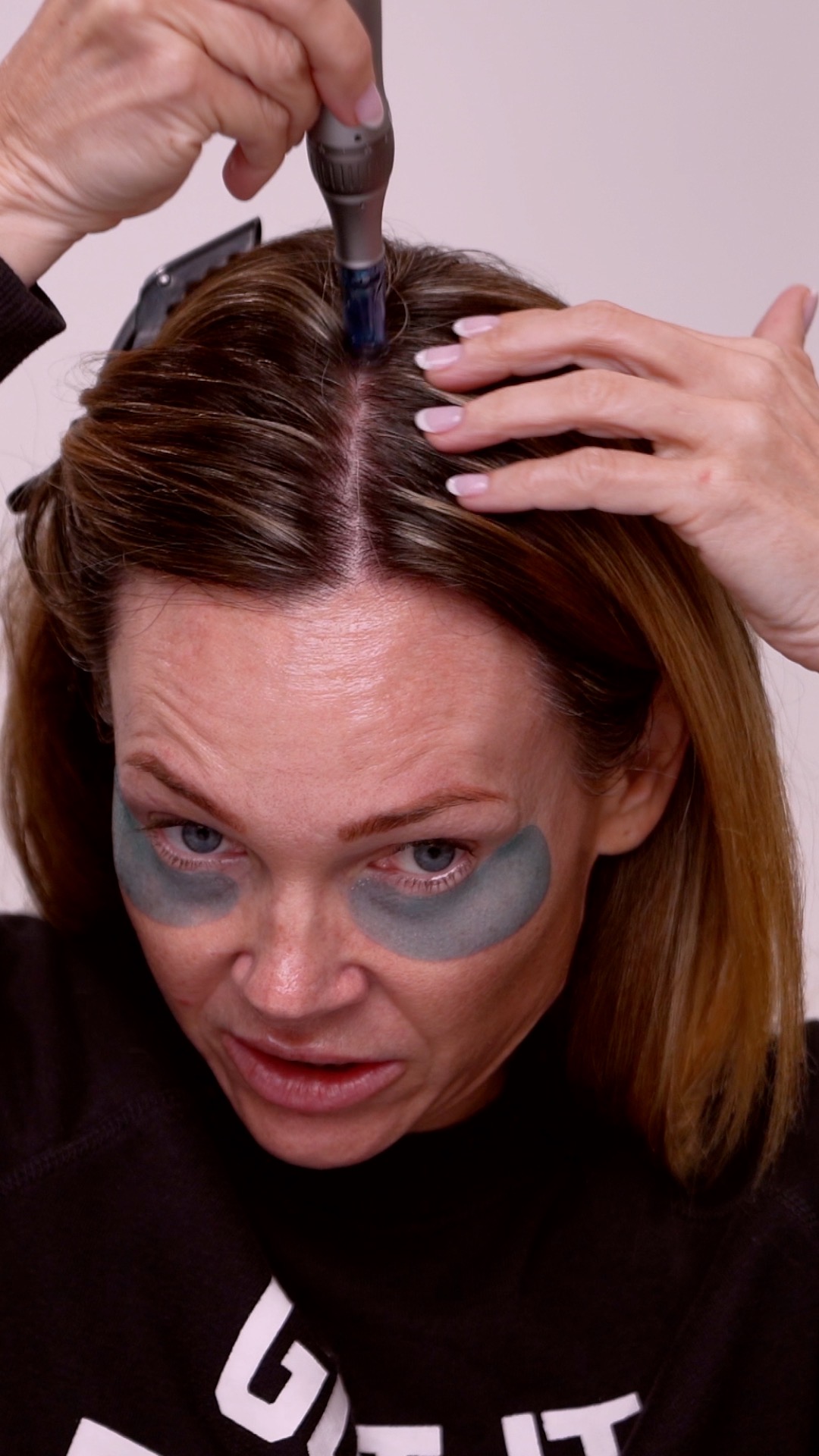Hair Luma Microneedling for the Scalp | A Complete Regenerative Hair Routine - treatment image