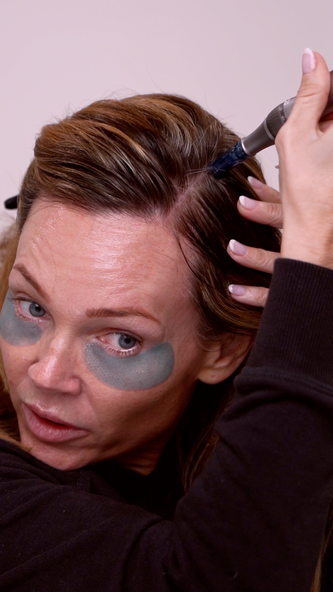 Hair Luma Microneedling for the Scalp | A Complete Regenerative Hair Routine - treatment image