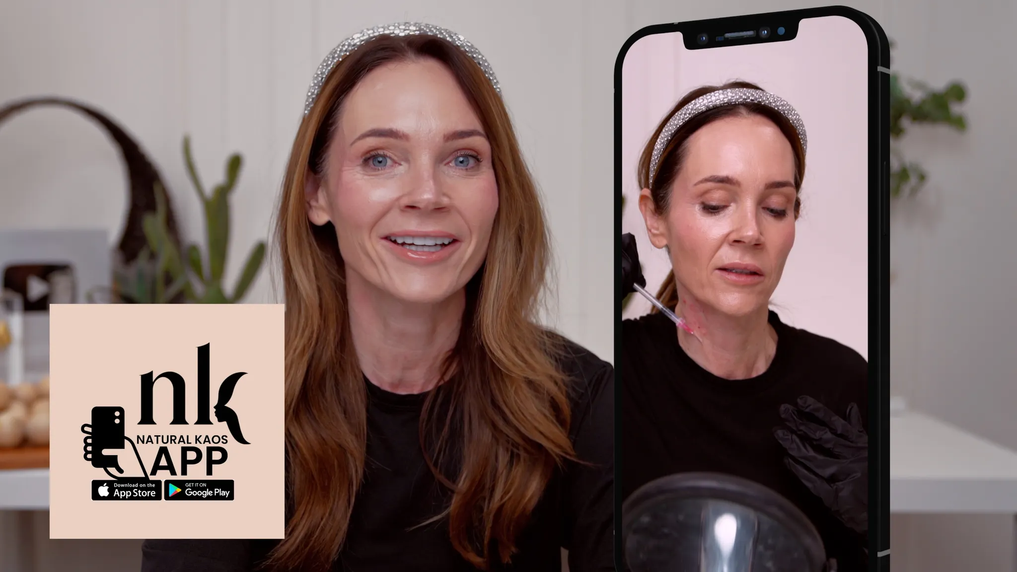 Russian Lip Filler Technique Explained: Why It Looks So Different - treatment image