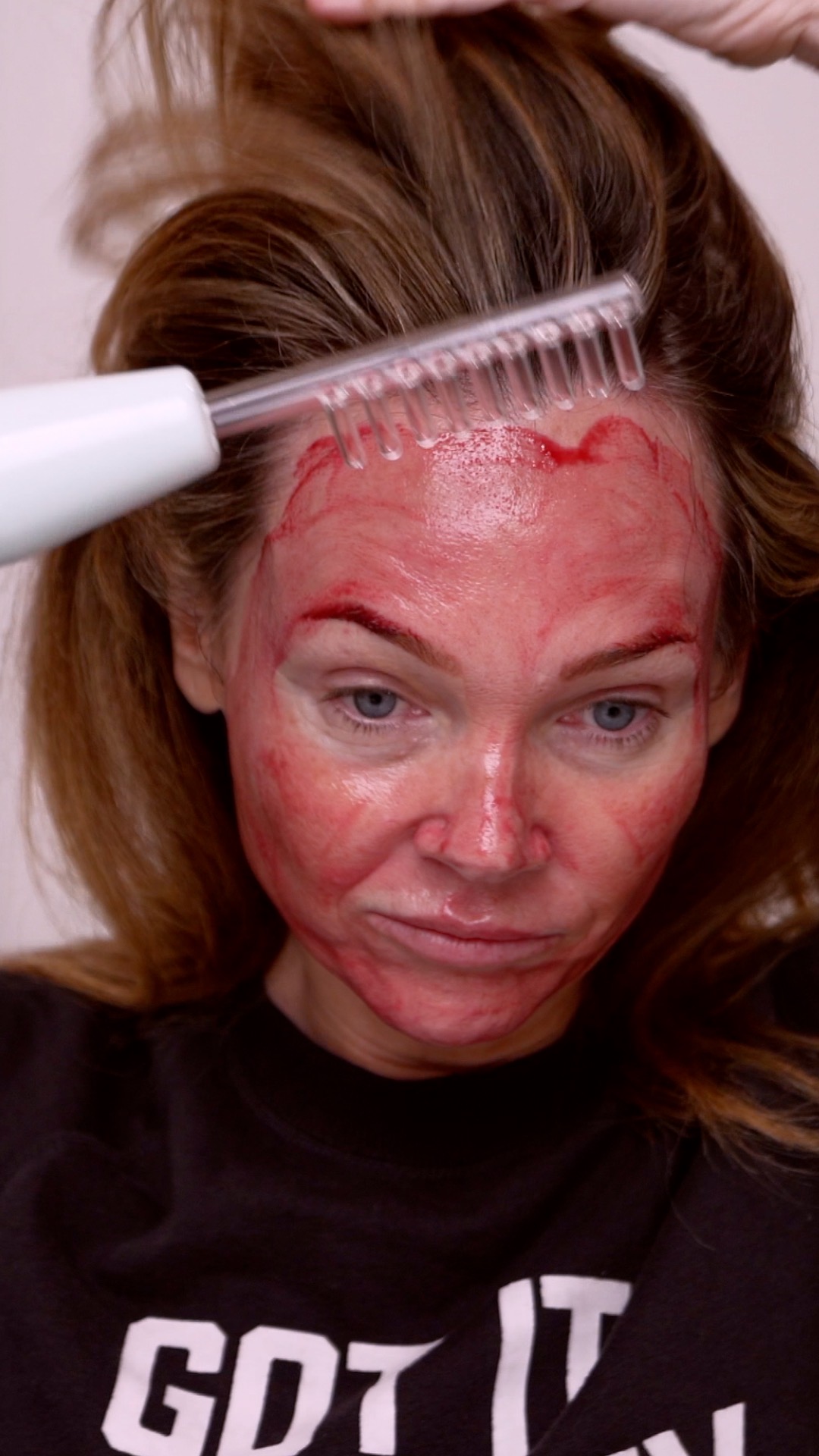 Hair Luma Microneedling for the Scalp | A Complete Regenerative Hair Routine - treatment image