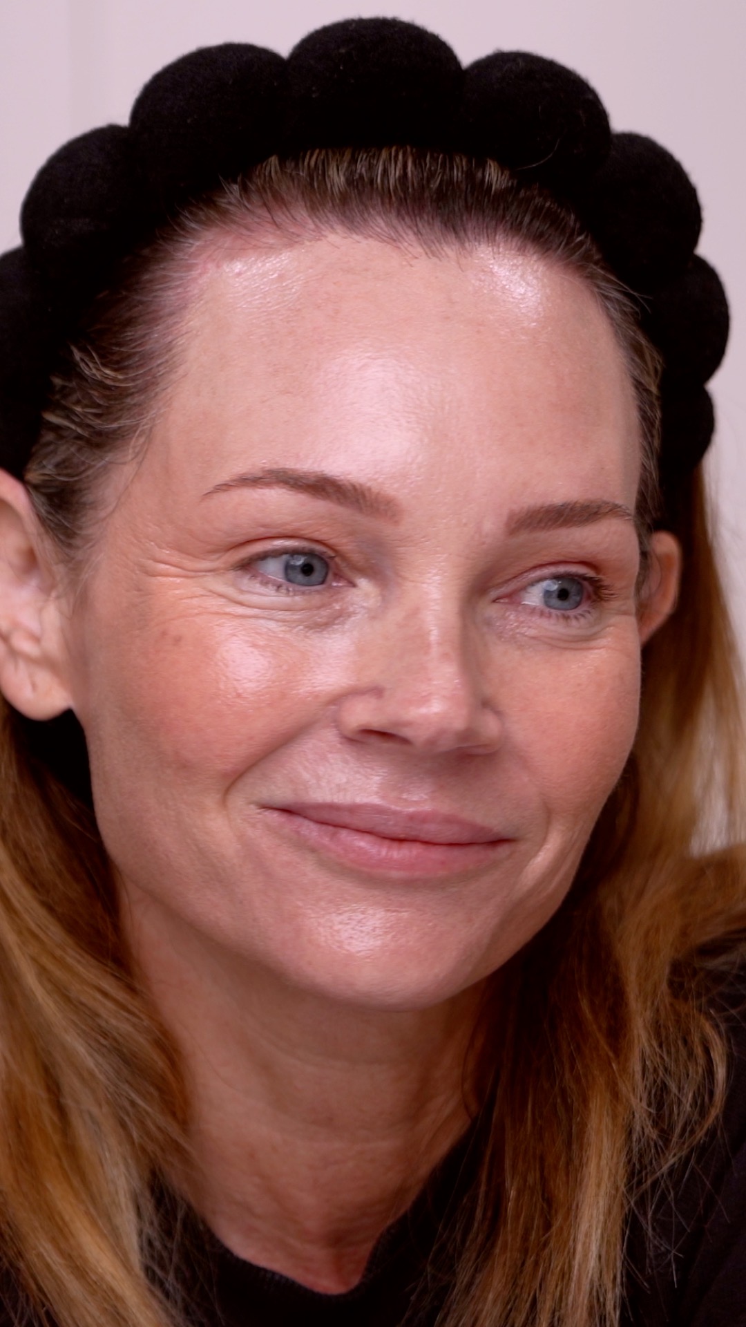 Hair Luma Microneedling for the Scalp | A Complete Regenerative Hair Routine - treatment image