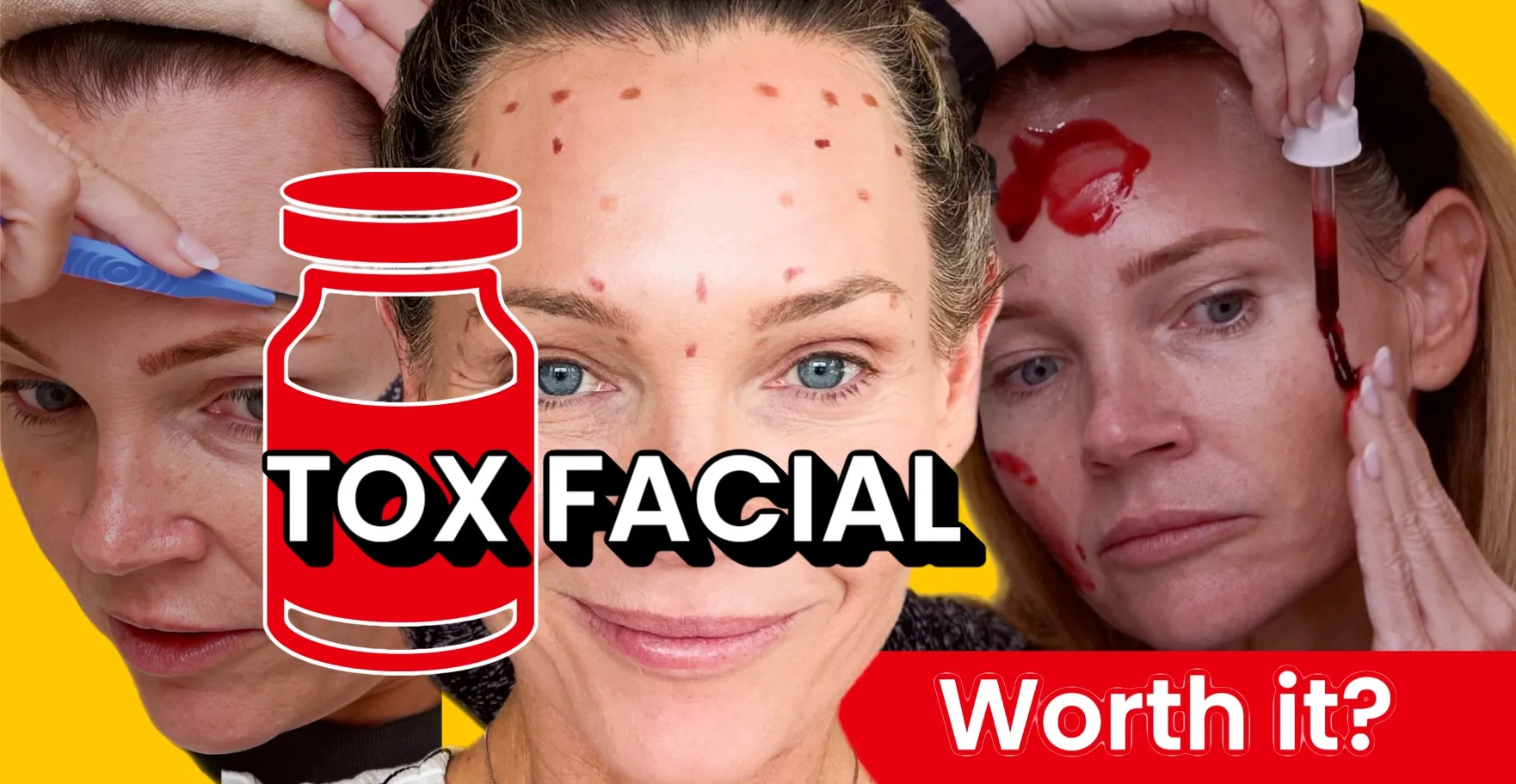 The Ultimate Skin Reset with Dermaplaning, The Ordinary Peel, and Tox Facial