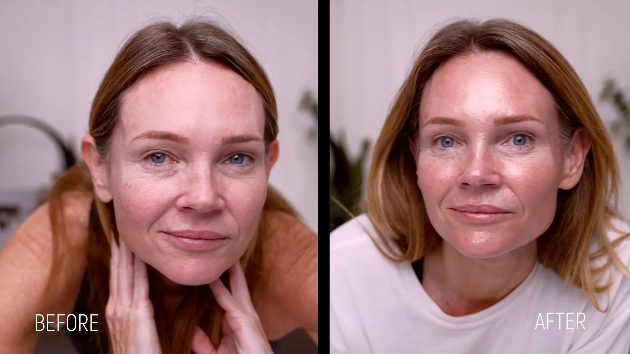 I Did a Full Skin Reset at Home… Dermaplaning + Chemical Peel + Tox Facial - treatment image