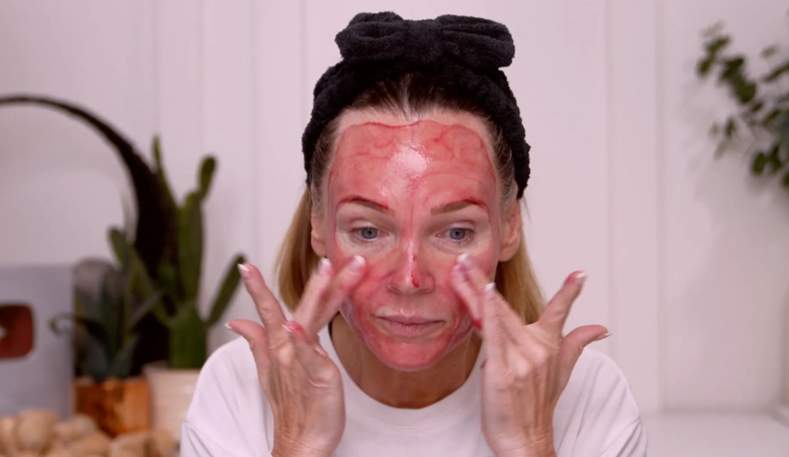 I Did a Full Skin Reset at Home… Dermaplaning + Chemical Peel + Tox Facial - treatment image