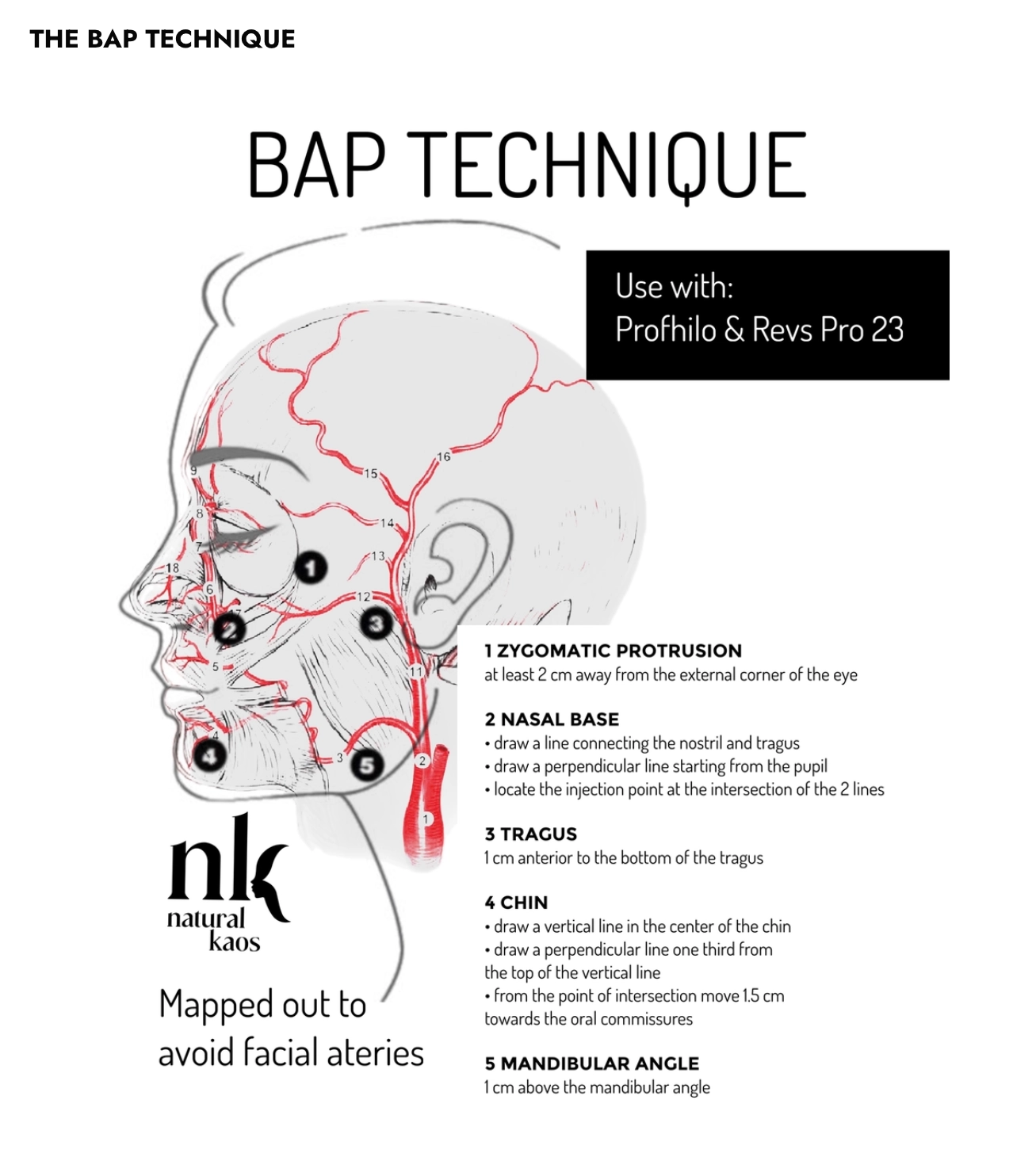 My Skin Quality and Neck Rejuvenation Plan With Revs Pro 32 + PCL Neck Threads - treatment image