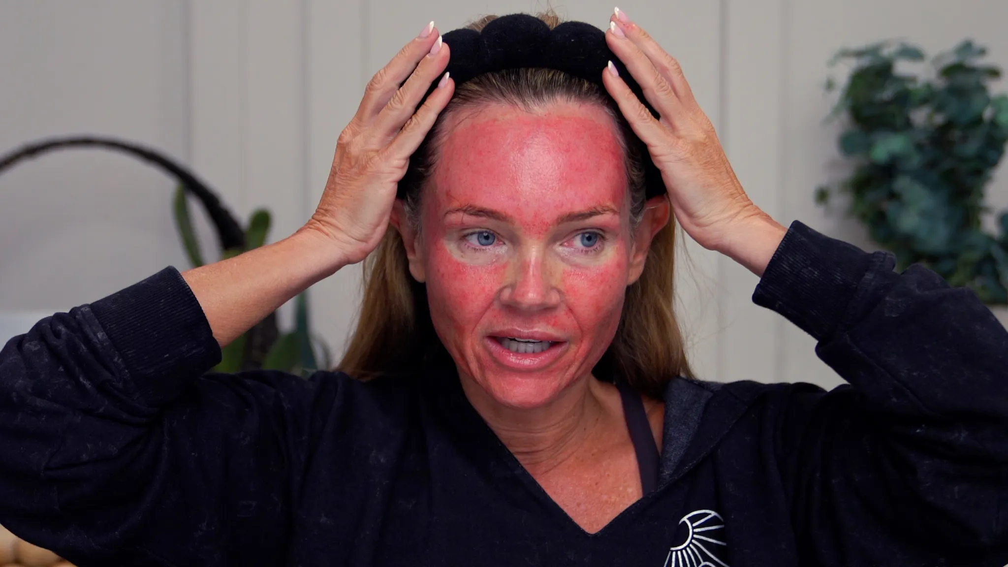 How I Numb Before Microneedling My Face My Complete Routine - treatment image