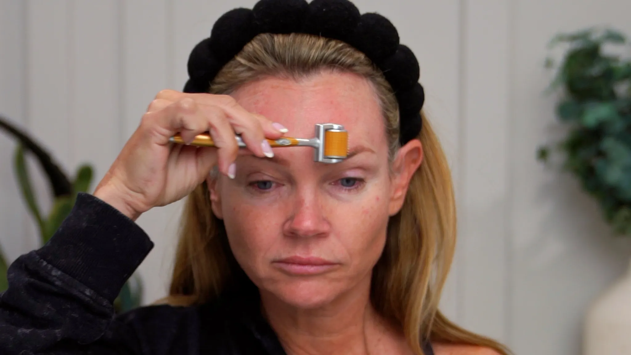 How I Numb Before Microneedling My Face My Complete Routine - treatment image