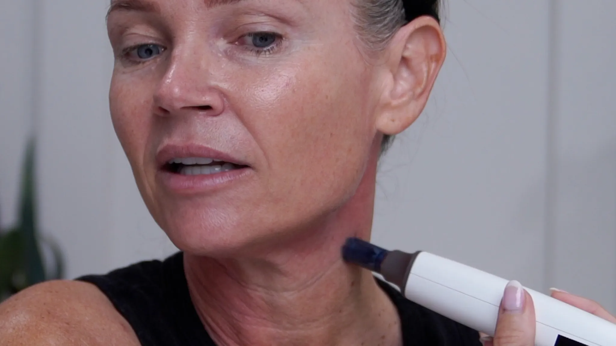 How I Microneedled My Neck at Home with the Dr. Pen M9 My 24-Hour Results